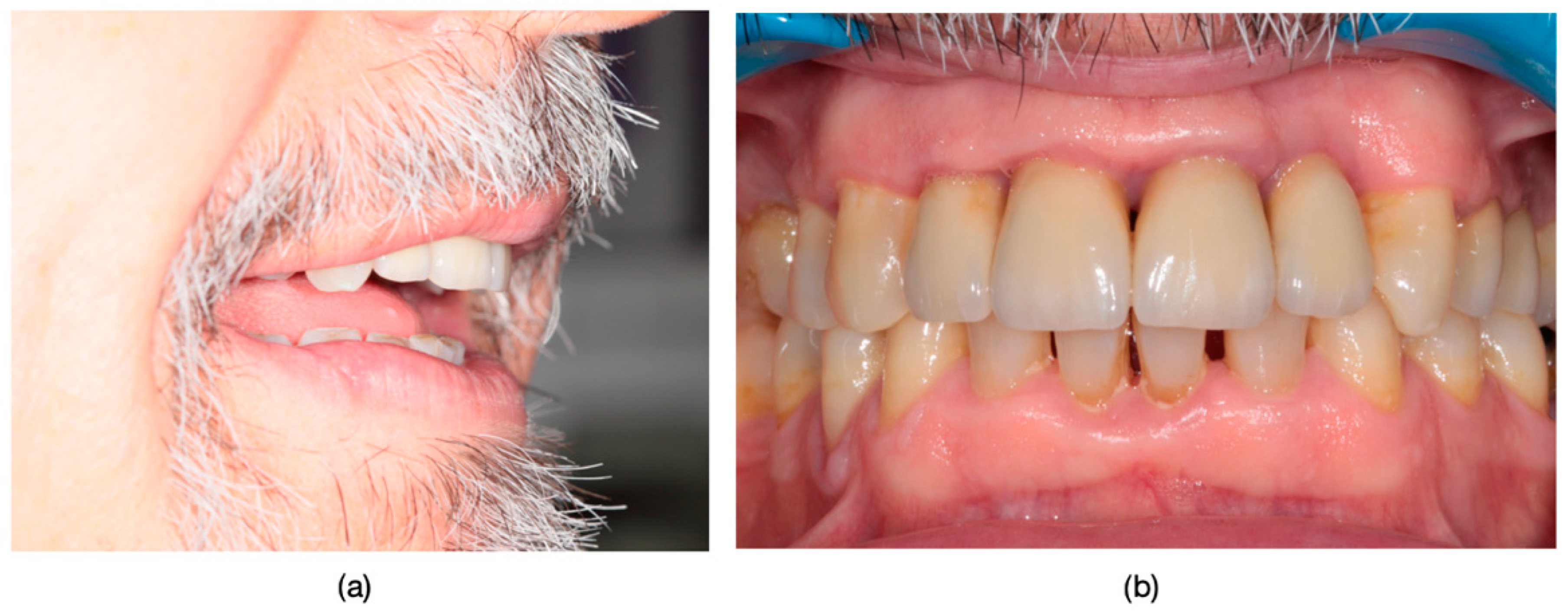 Dentistry 13 00044 g011