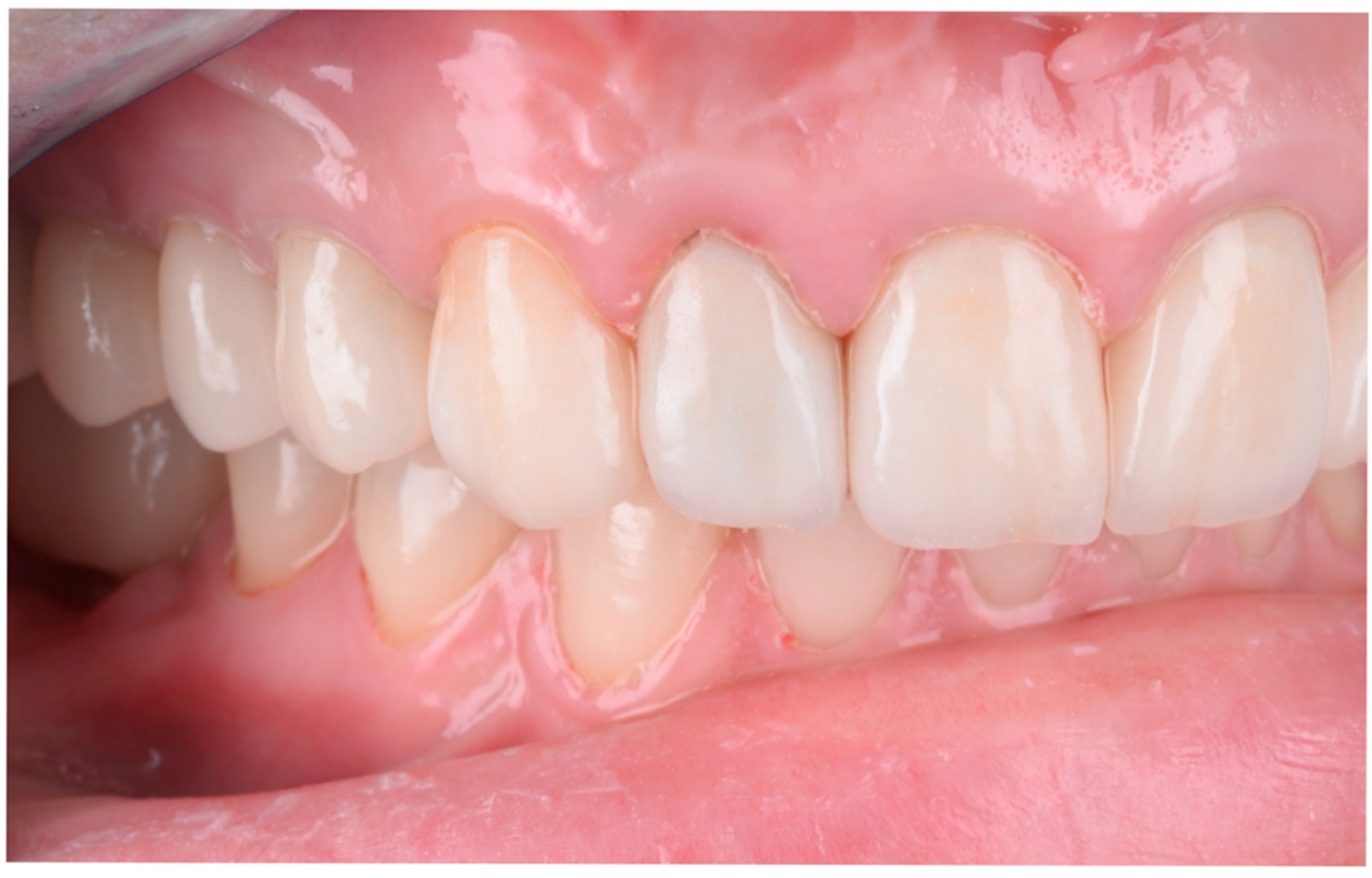 Dentistry 13 00044 g012