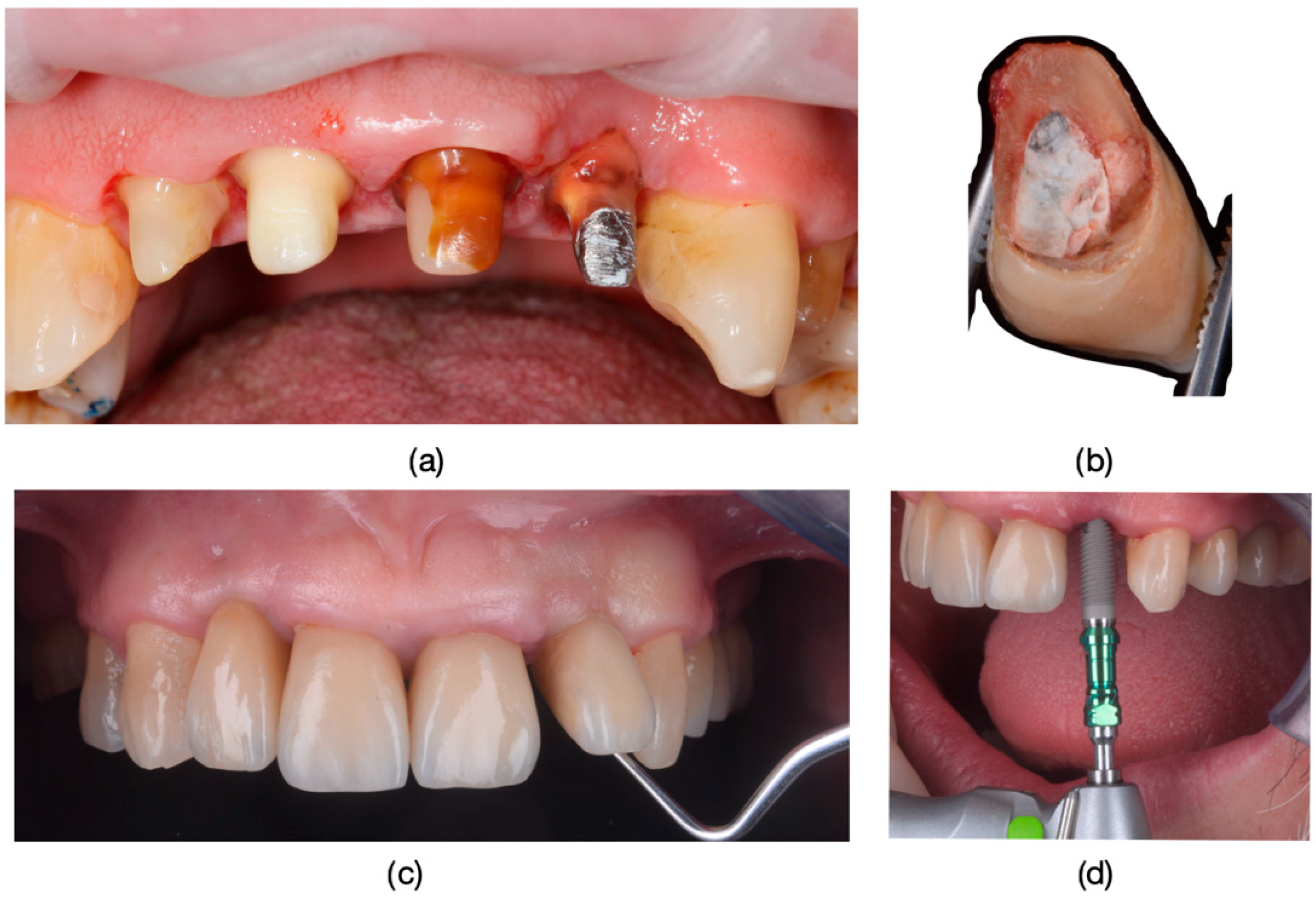 Dentistry 13 00044 g013