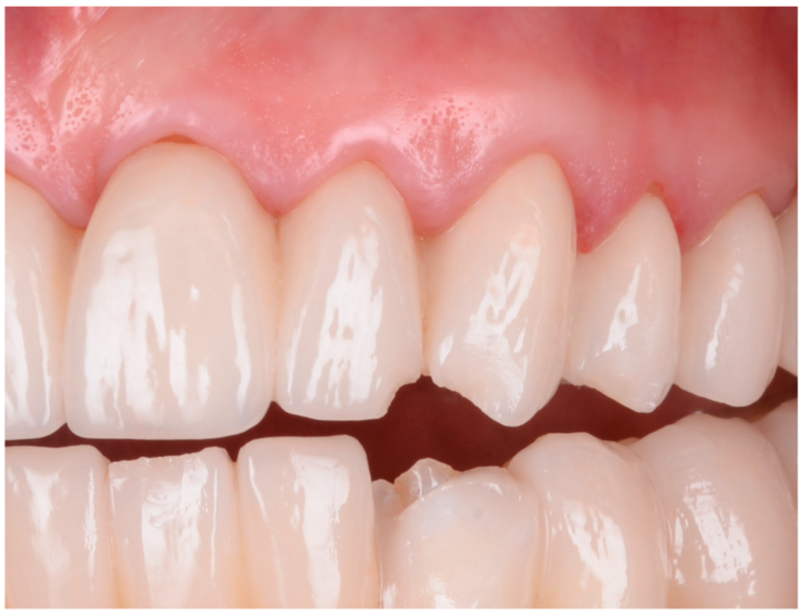 Dentistry 13 00044 g015