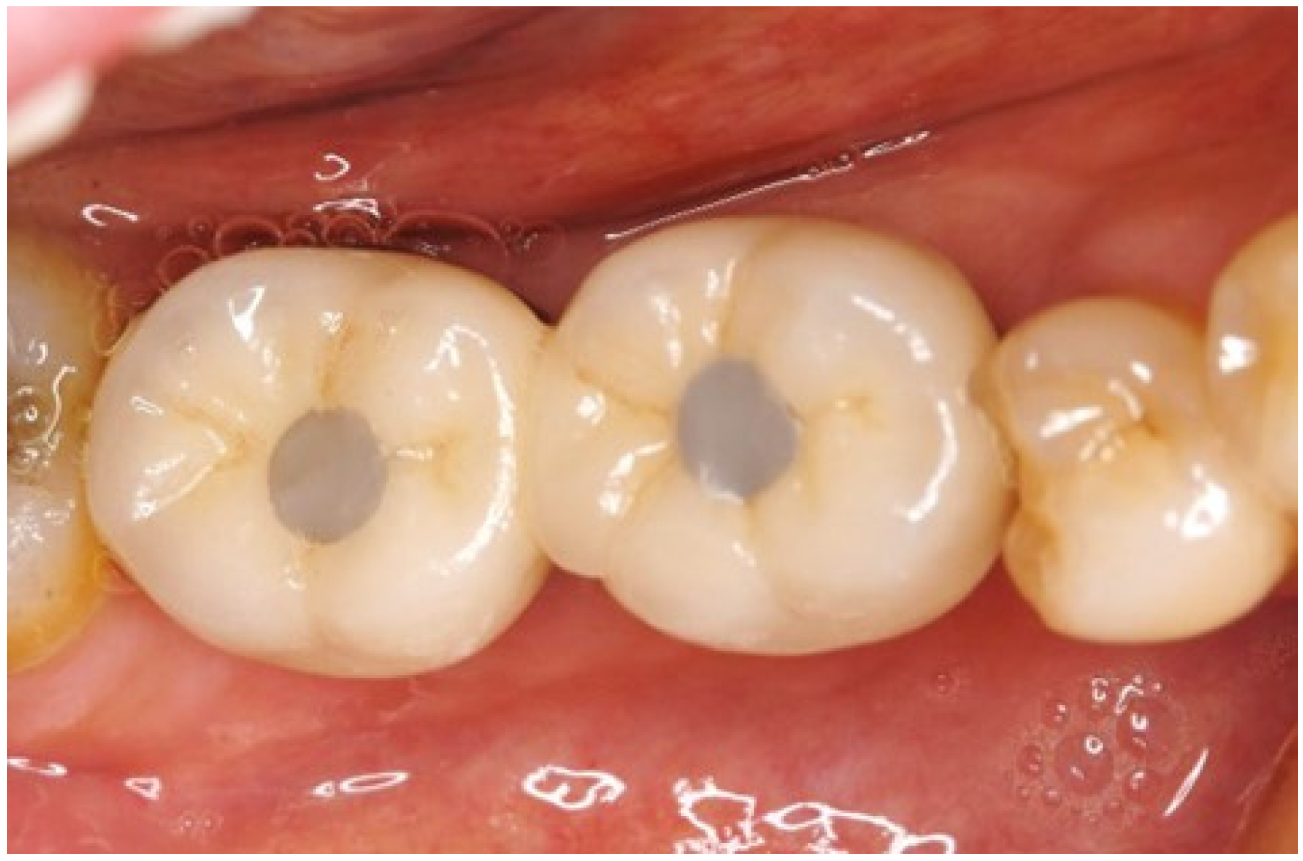 Dentistry 13 00053 g001