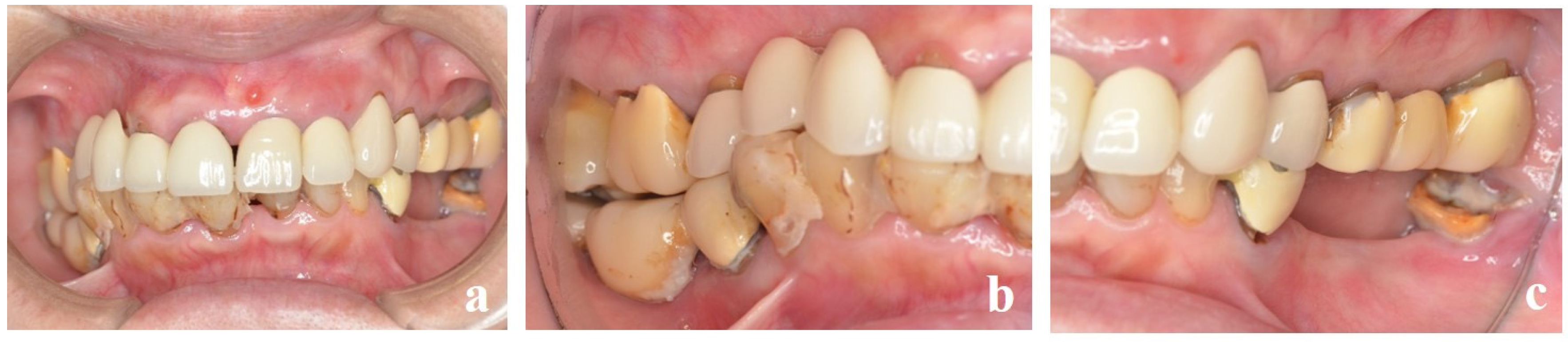 Dentistry 13 00053 g002