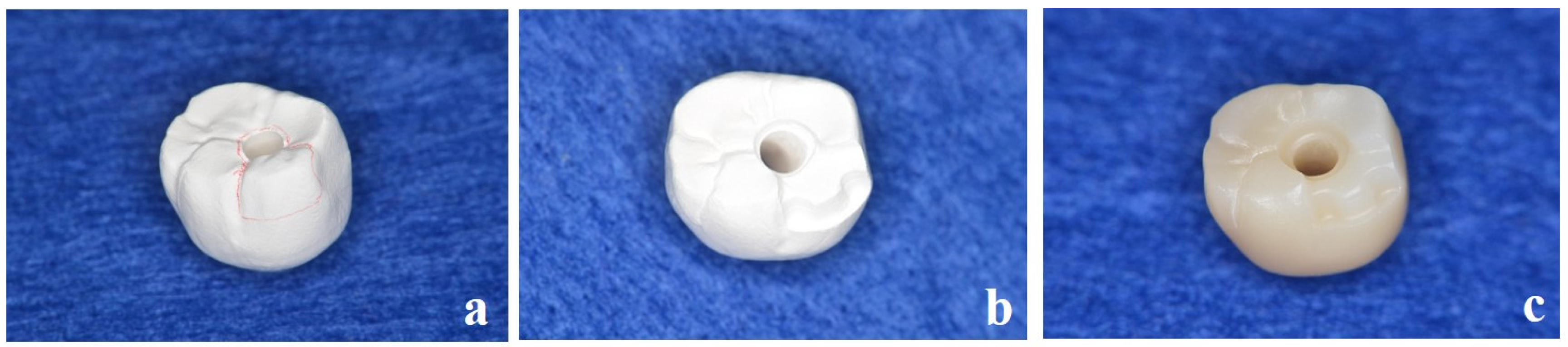 Dentistry 13 00053 g004