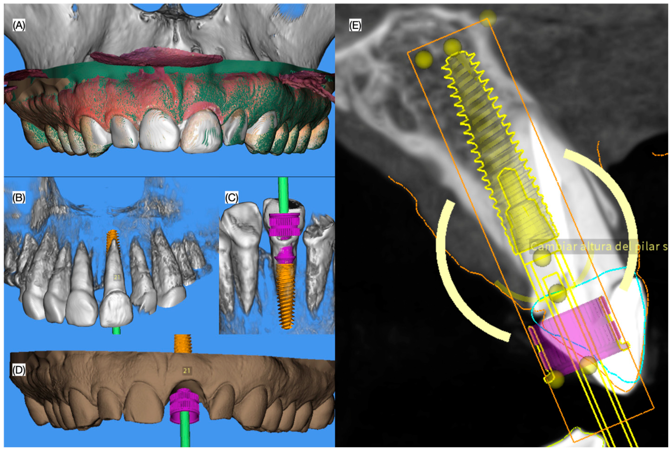 Dentistry 13 00073 g002