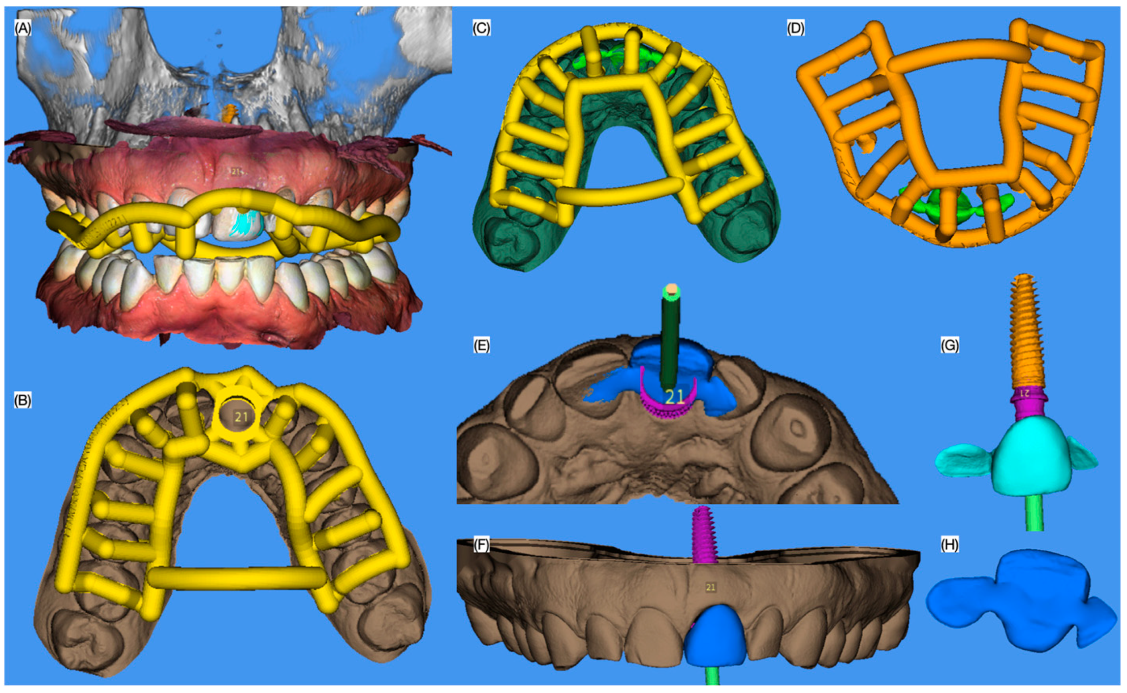 Dentistry 13 00073 g003