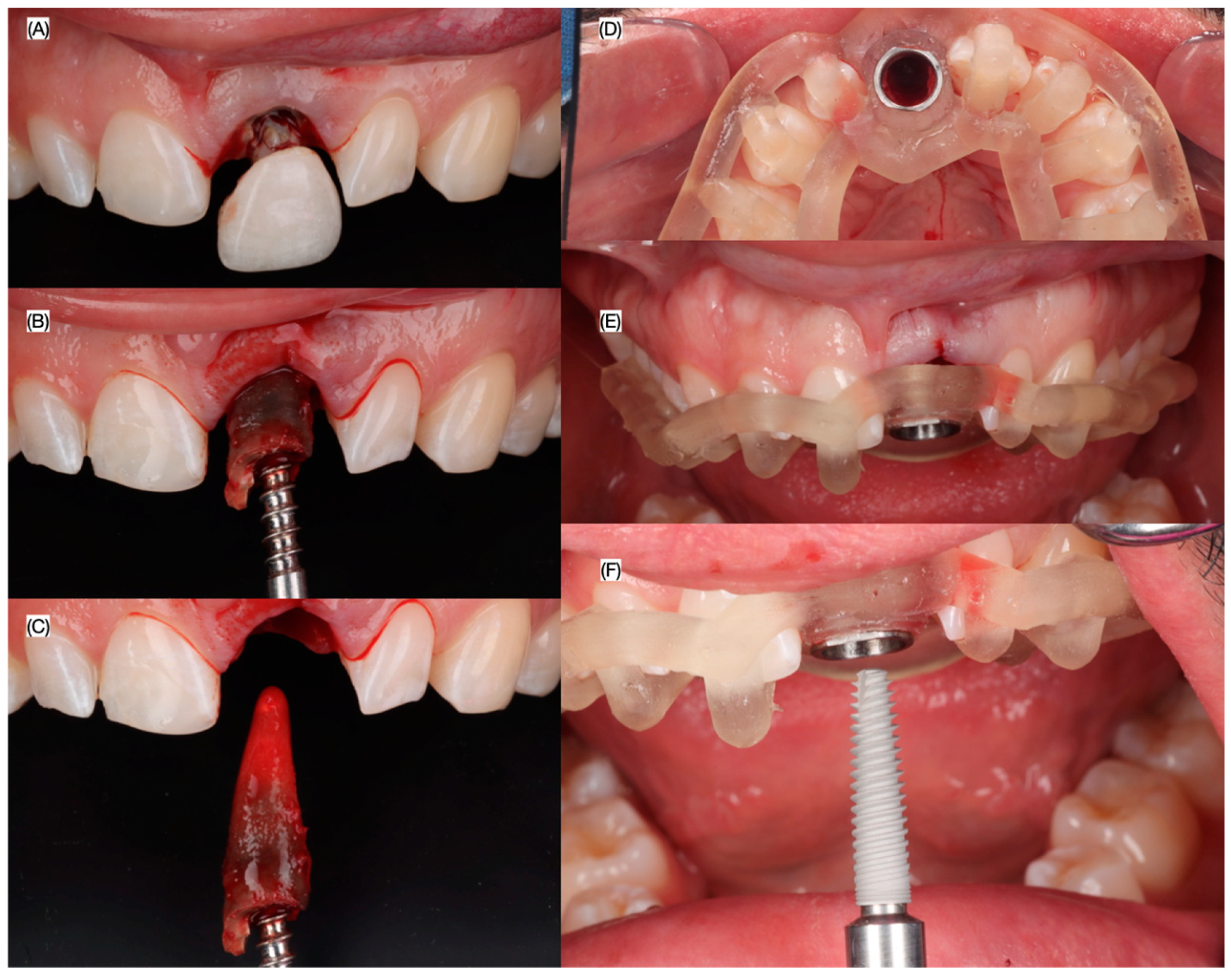 Dentistry 13 00073 g005