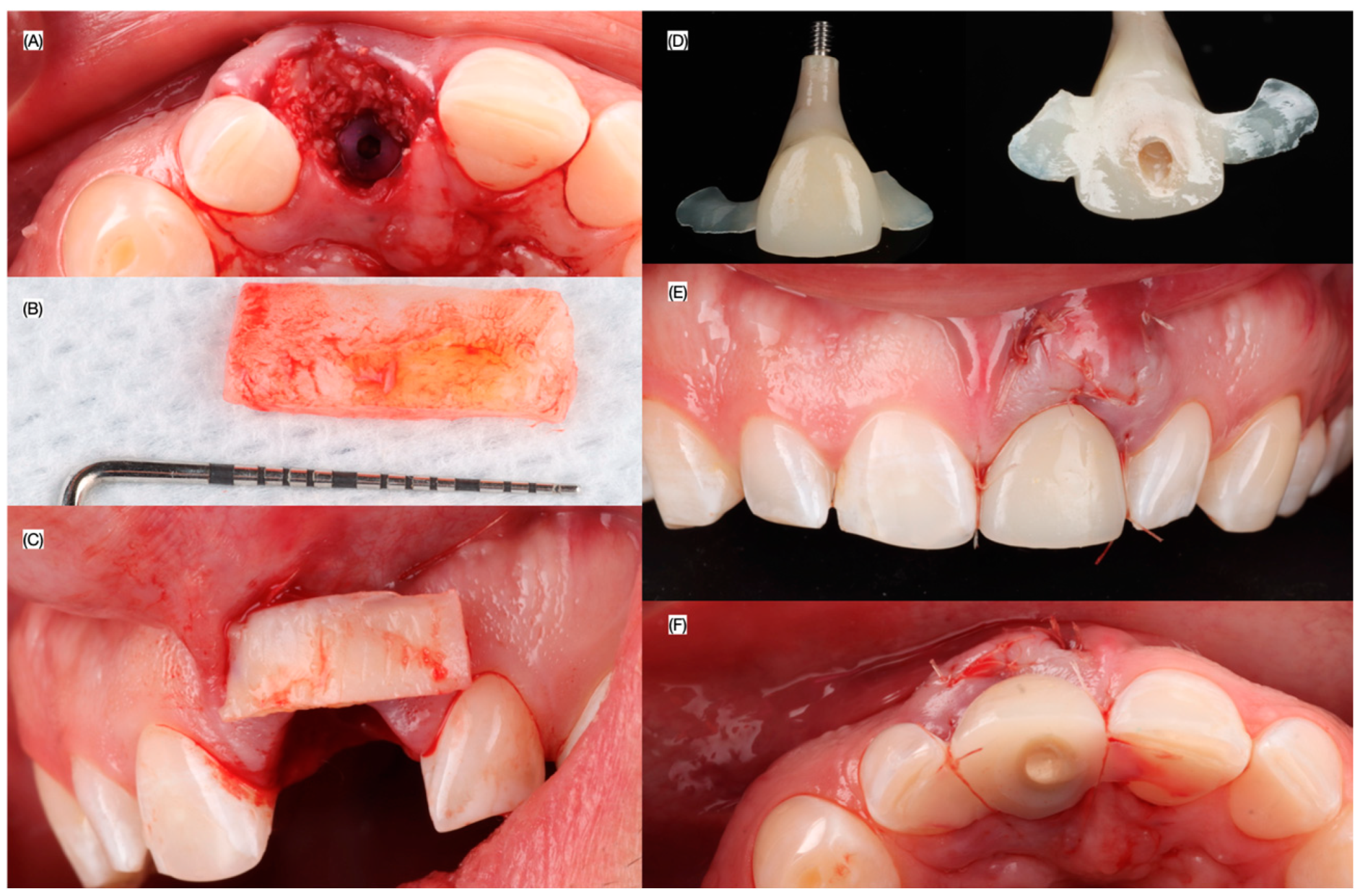 Dentistry 13 00073 g006