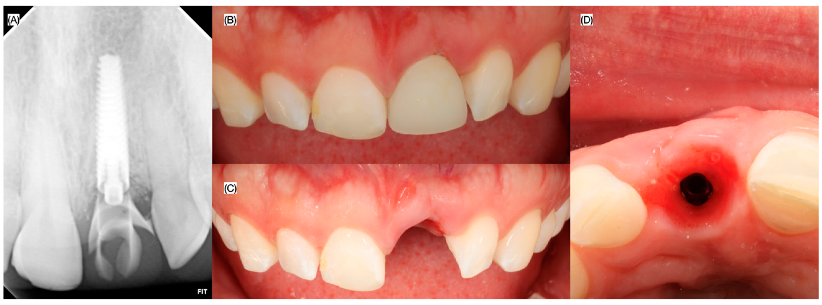 Dentistry 13 00073 g007