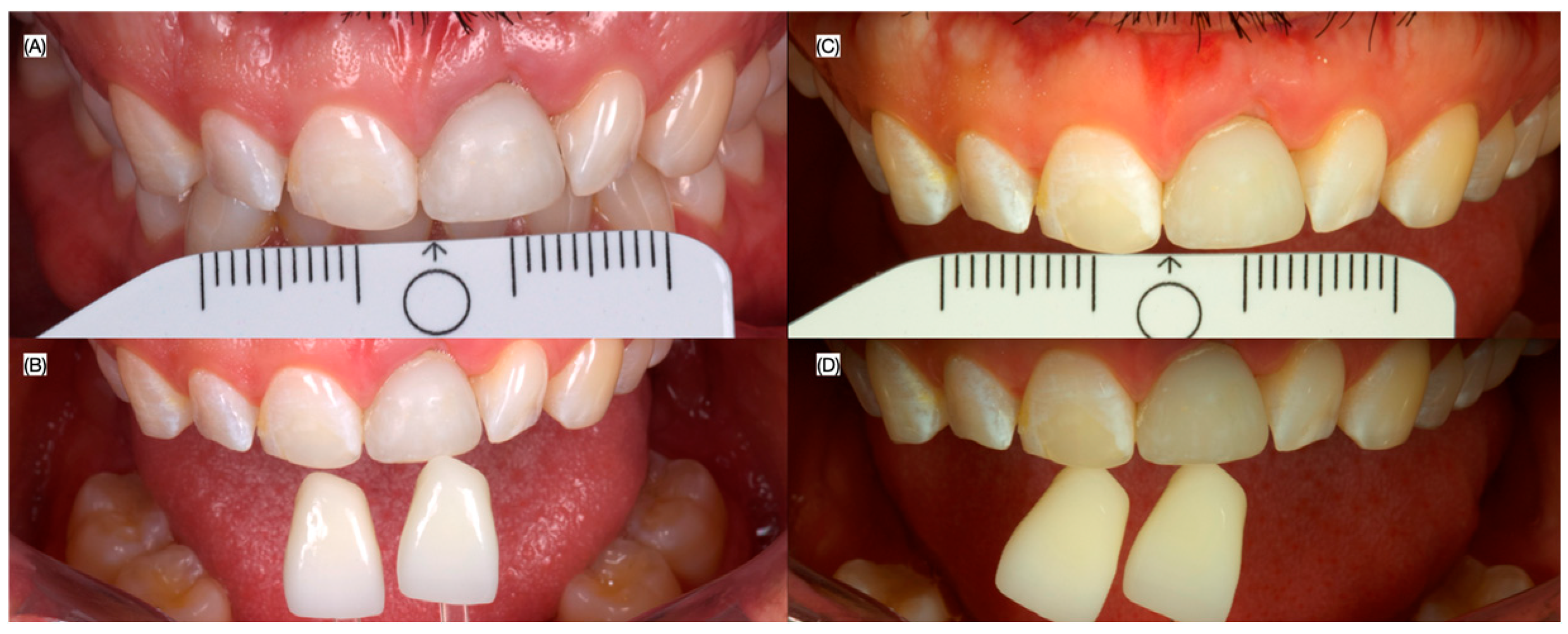 Dentistry 13 00073 g009
