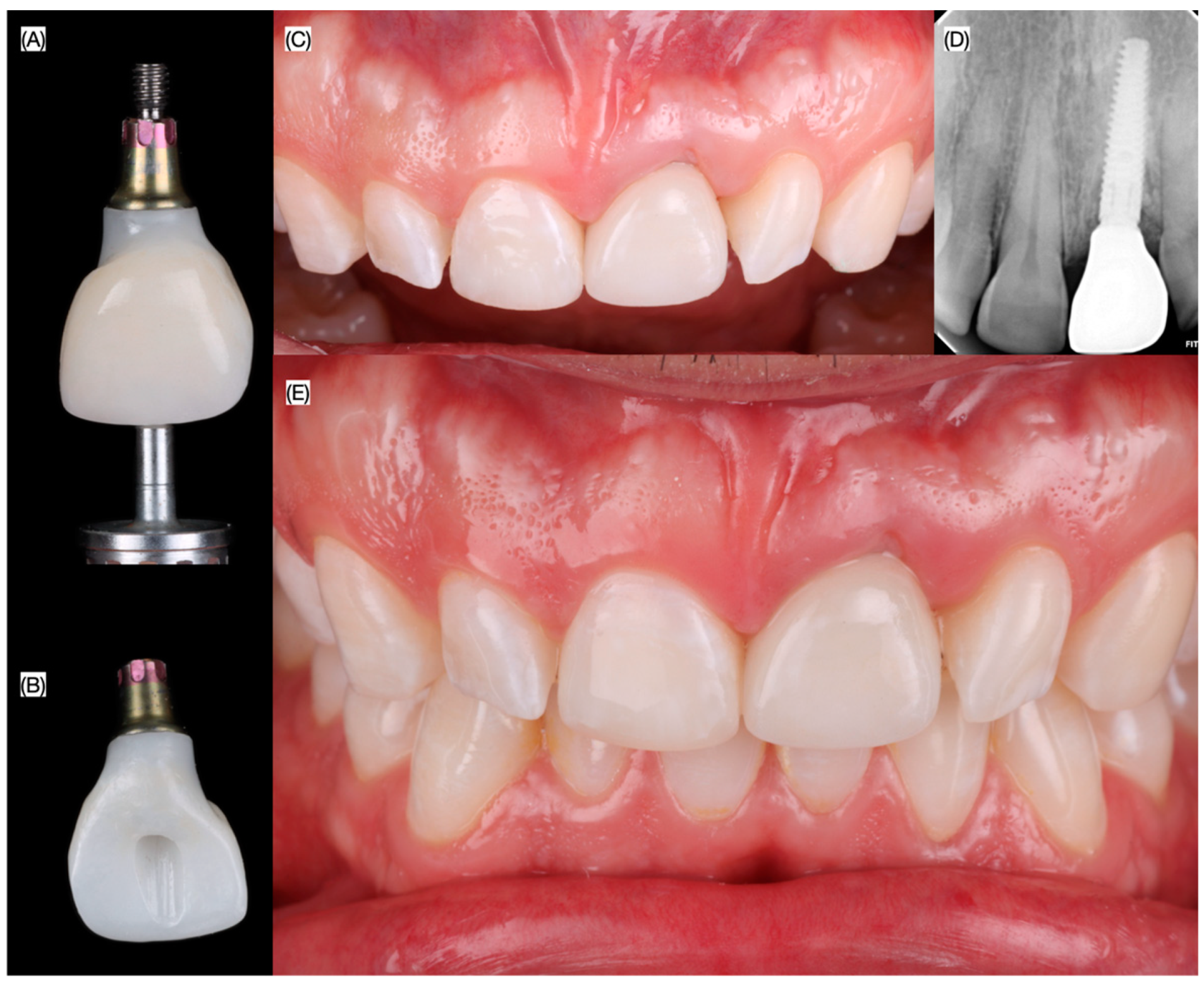Dentistry 13 00073 g010