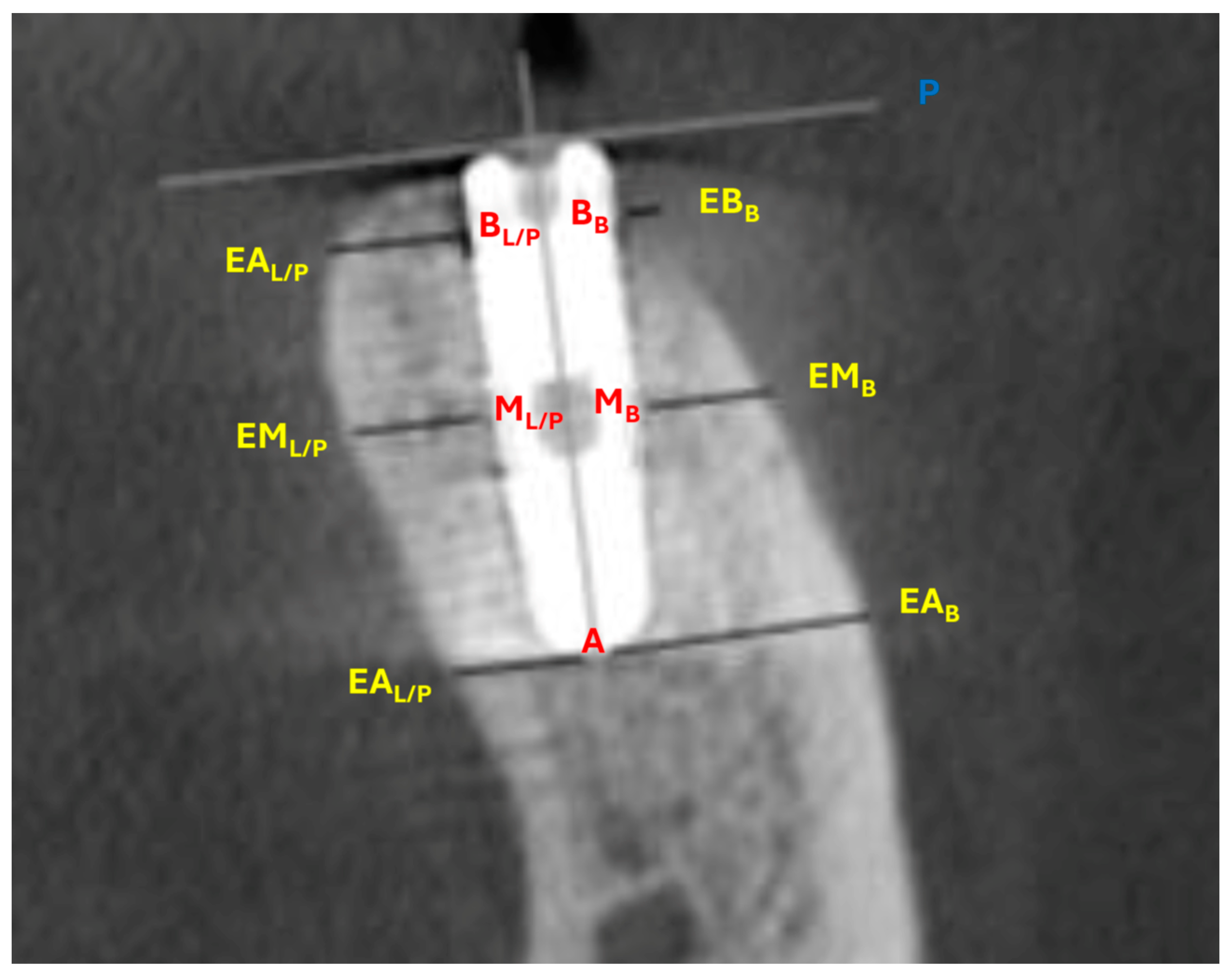 Dentistry 13 00078 g004