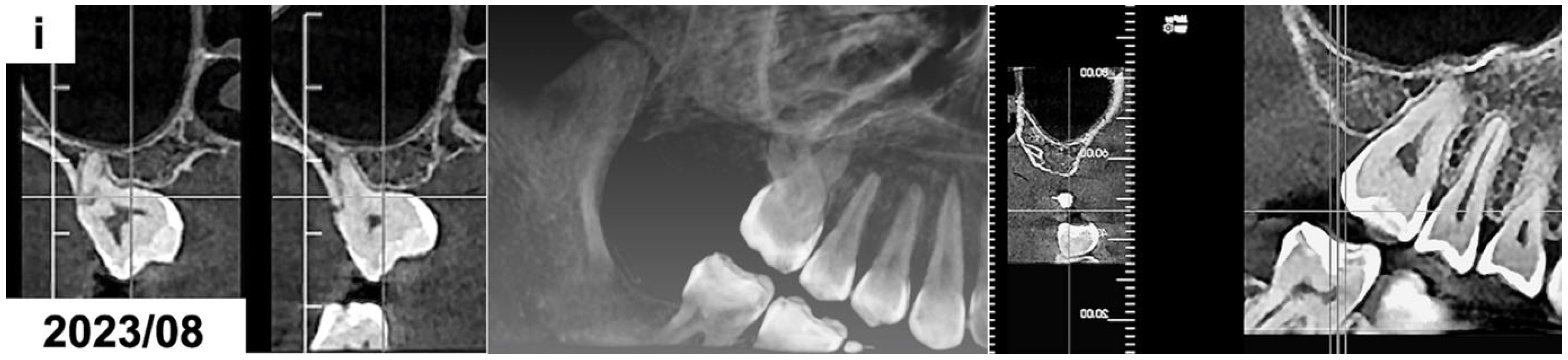 Dentistry 13 00082 g002c