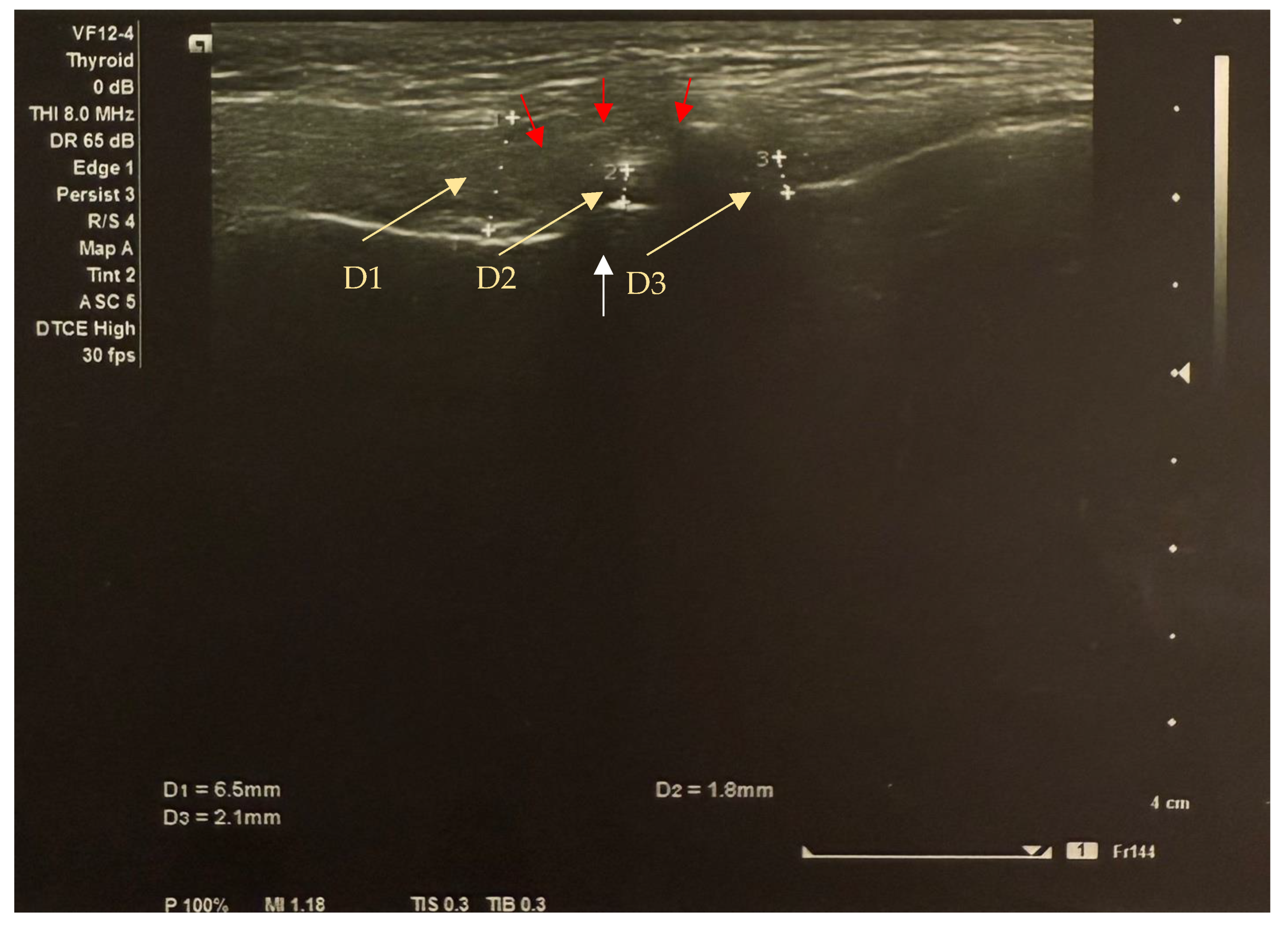 Dentistry 13 00084 g002 Dentistry 13 00084 g002