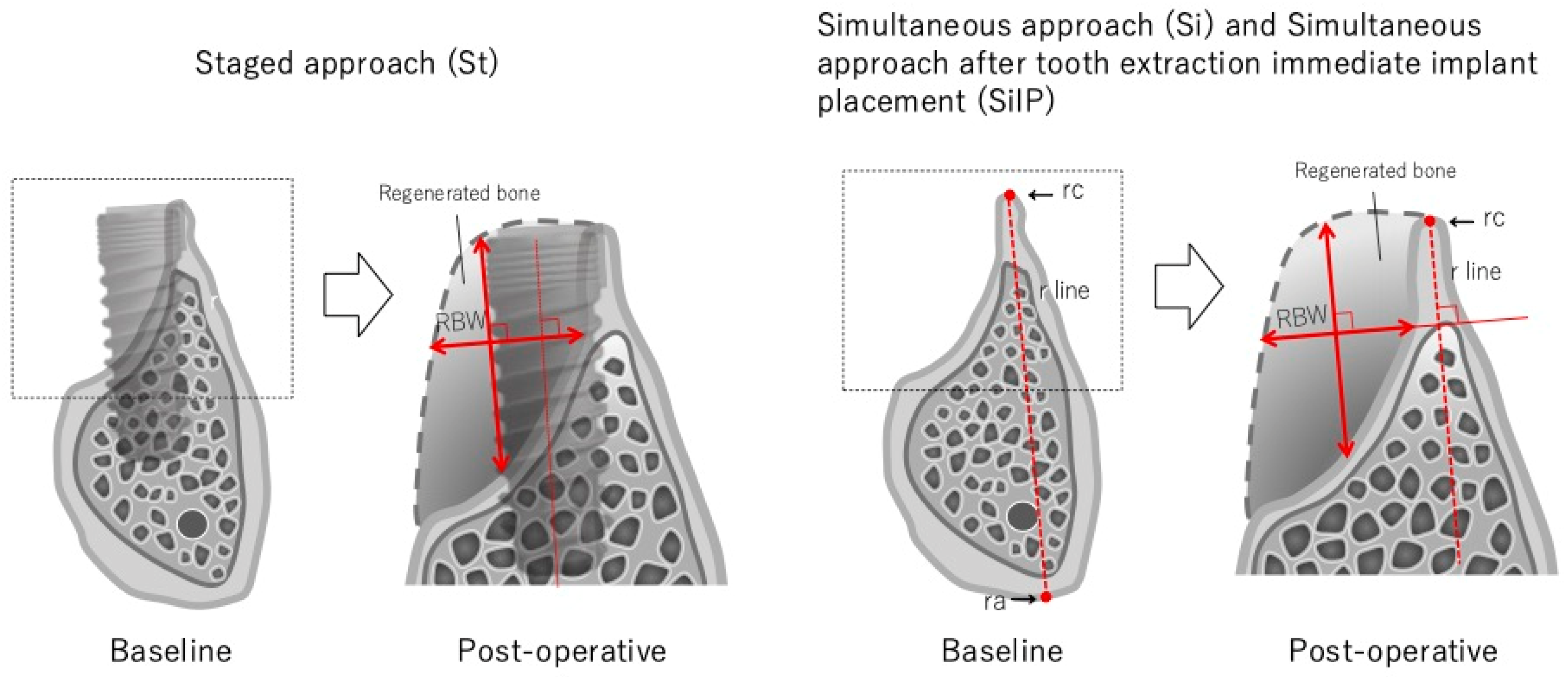 Dentistry 13 00085 g002