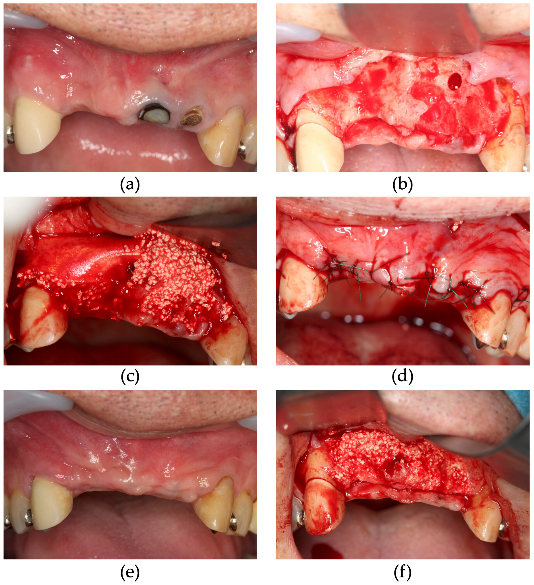 Dentistry 13 00085 g003a