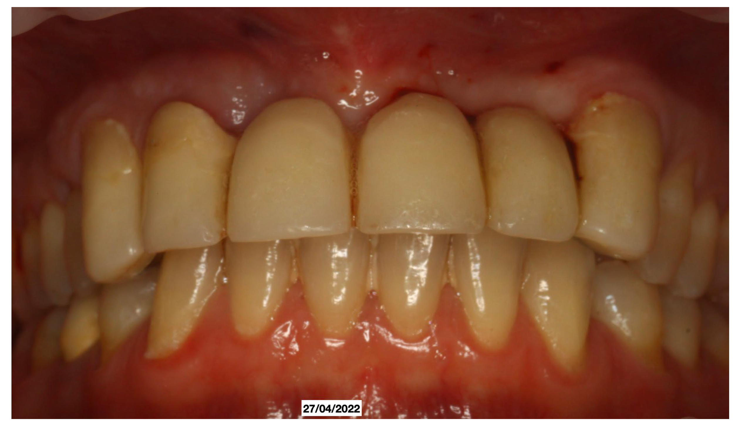 Dentistry 13 00128 g004