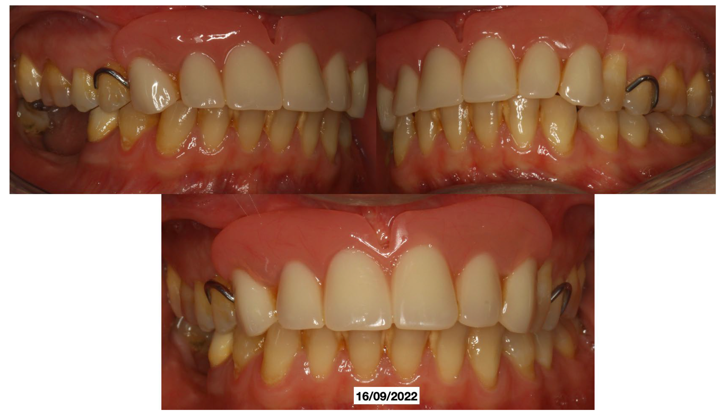 Dentistry 13 00128 g005