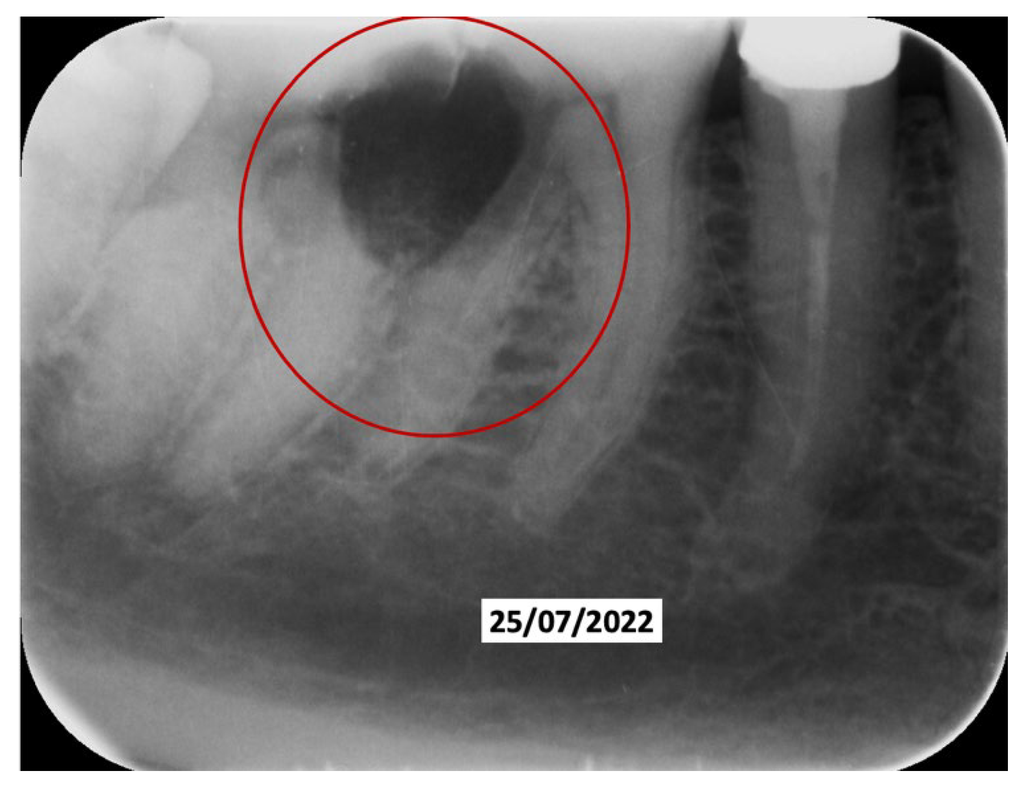 Dentistry 13 00128 g006