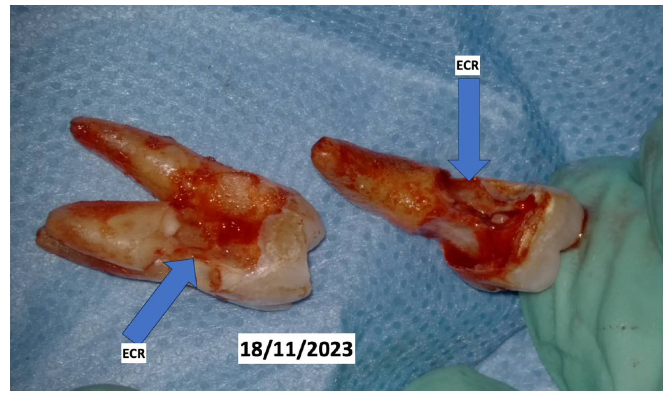 Dentistry 13 00128 g008