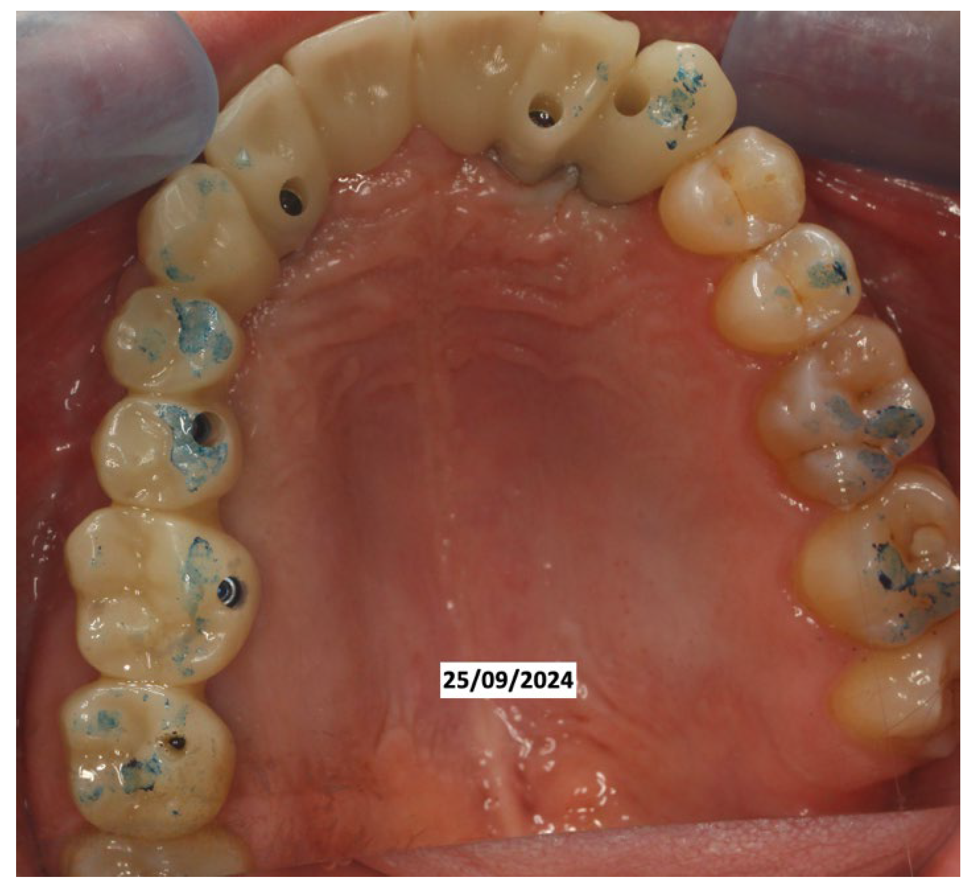 Dentistry 13 00128 g009