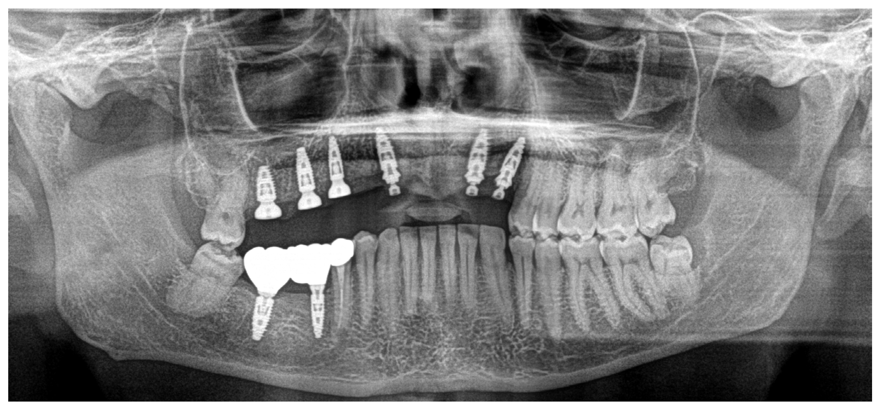 Dentistry 13 00128 g010