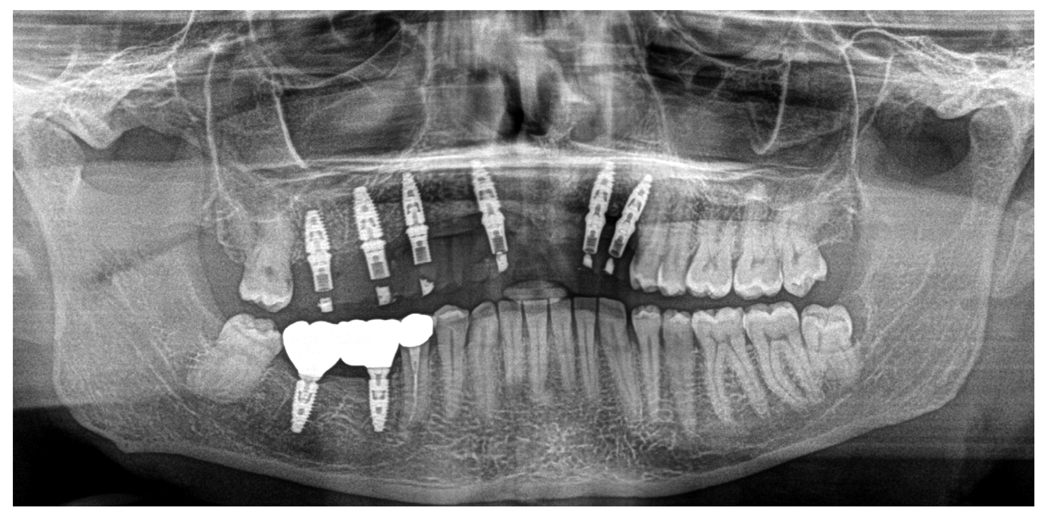 Dentistry 13 00128 g011