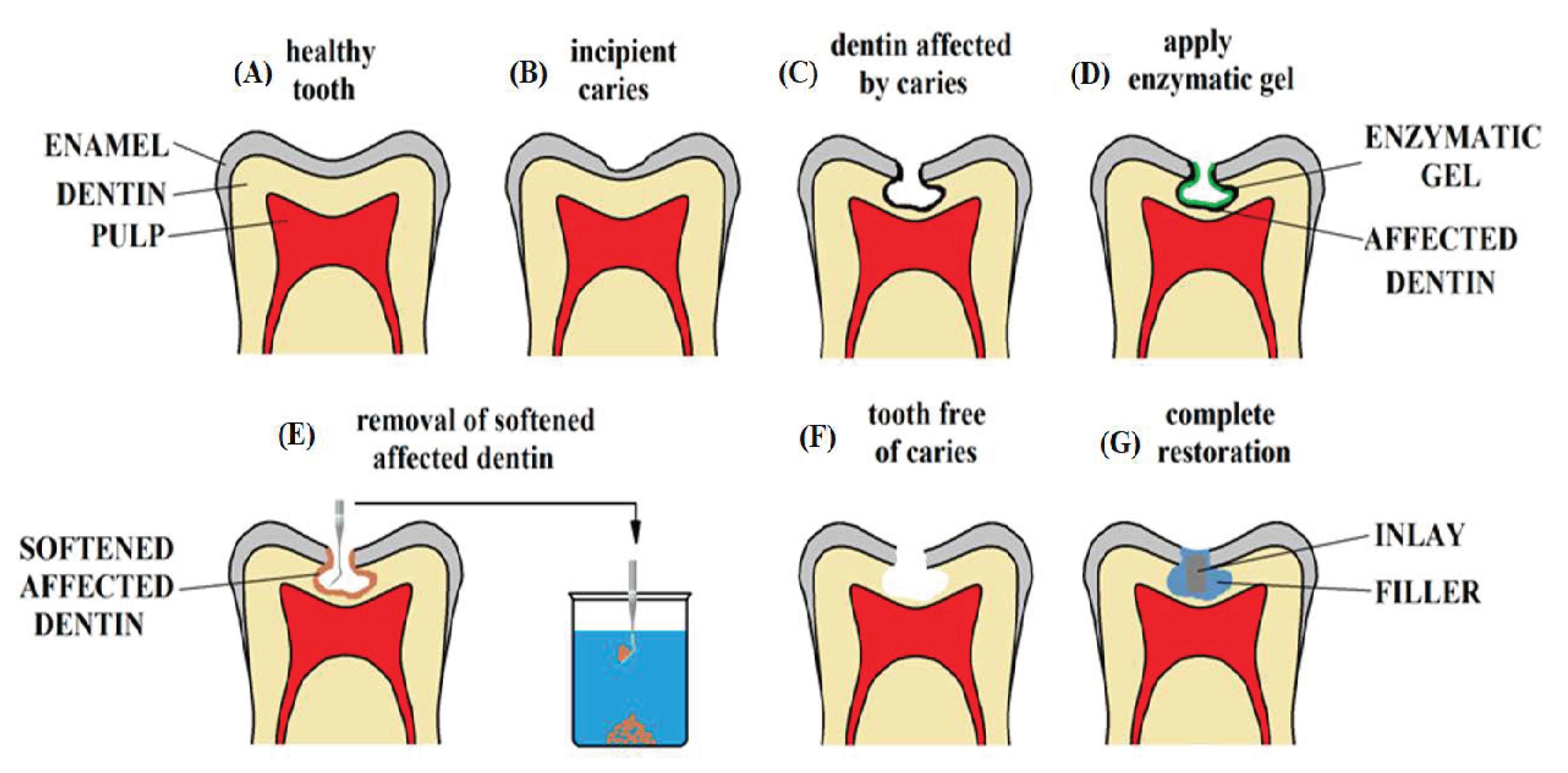 Dentistry 13 00132 g001