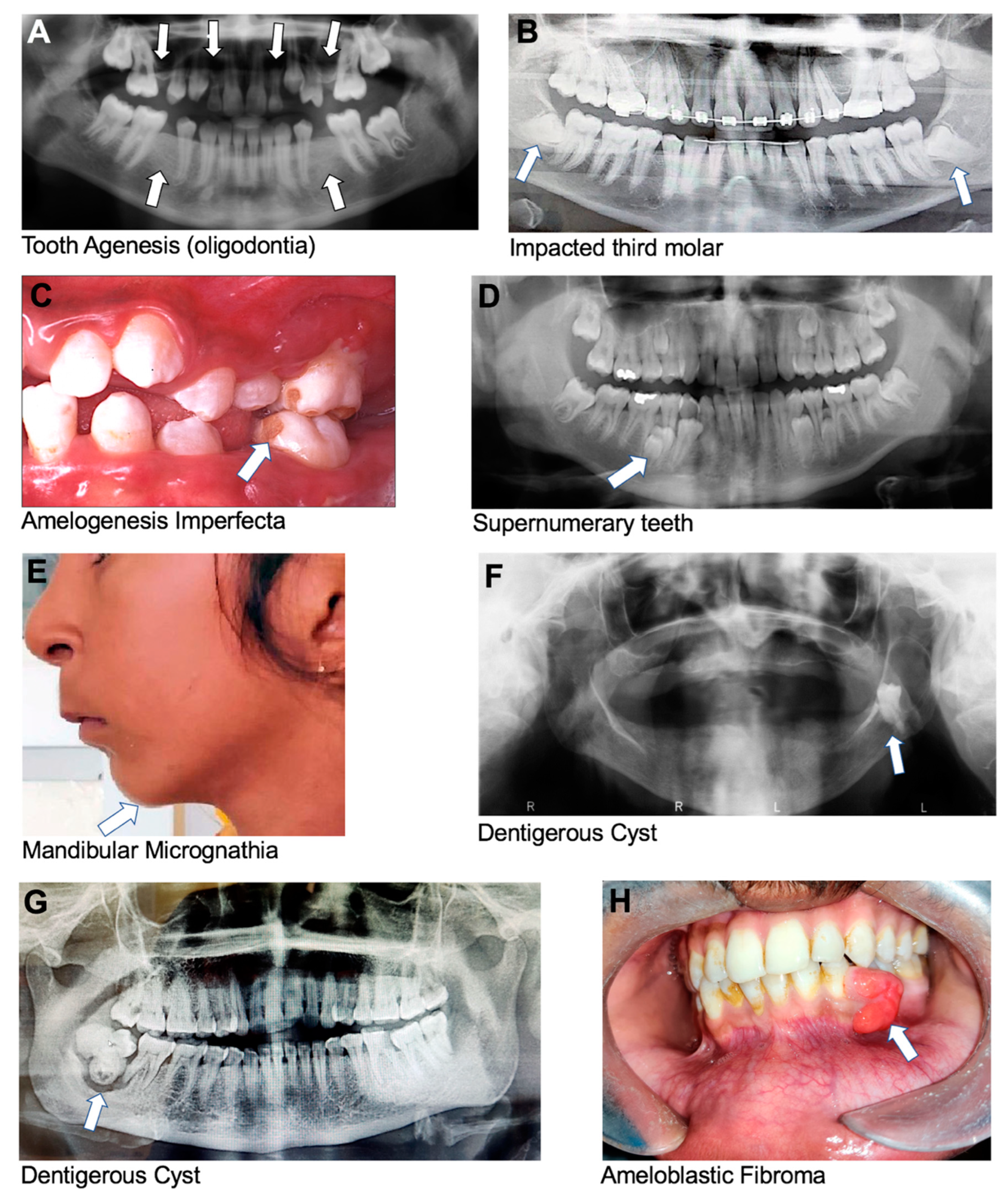Dentistry 13 00133 g002