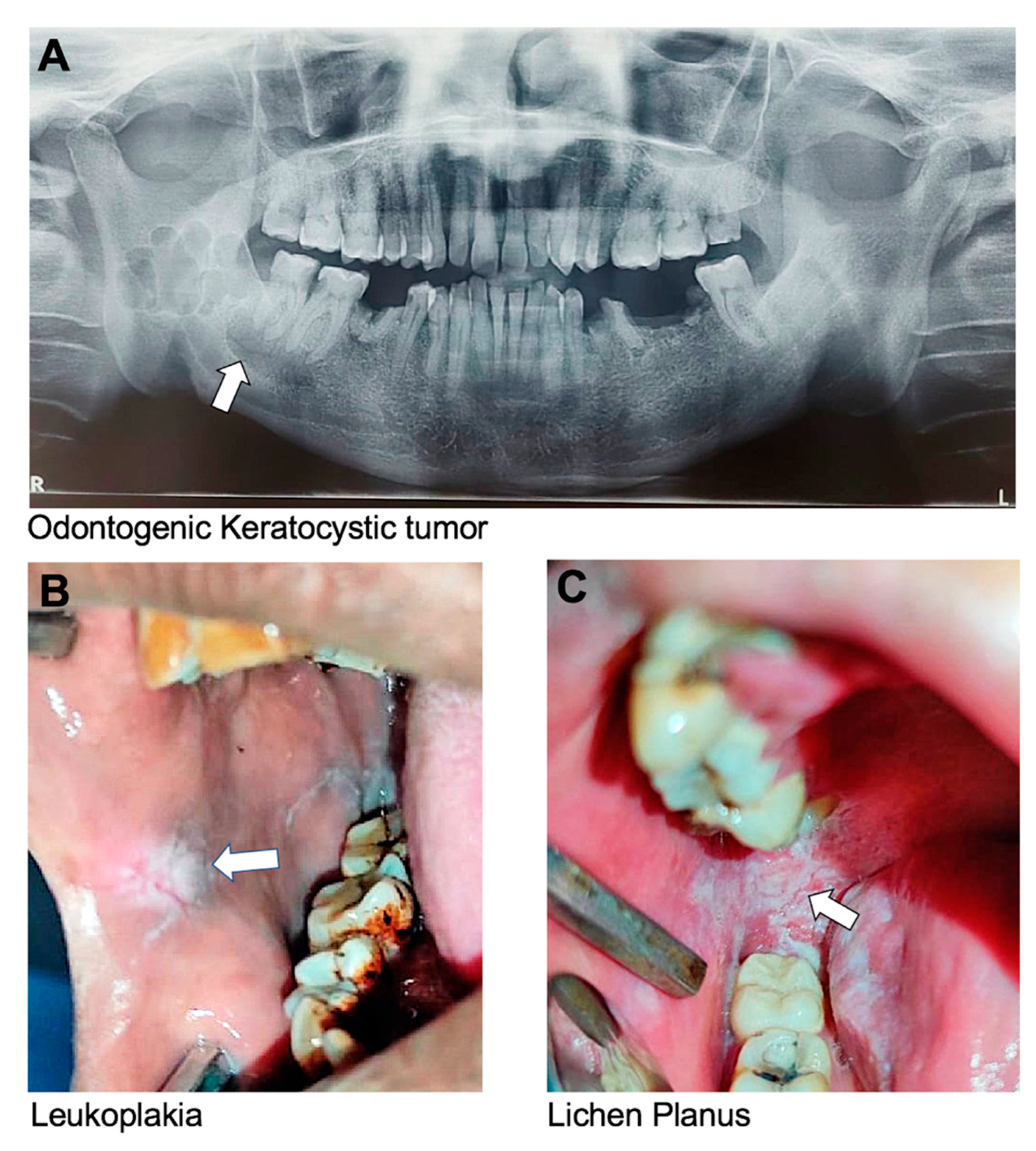 Dentistry 13 00133 g003