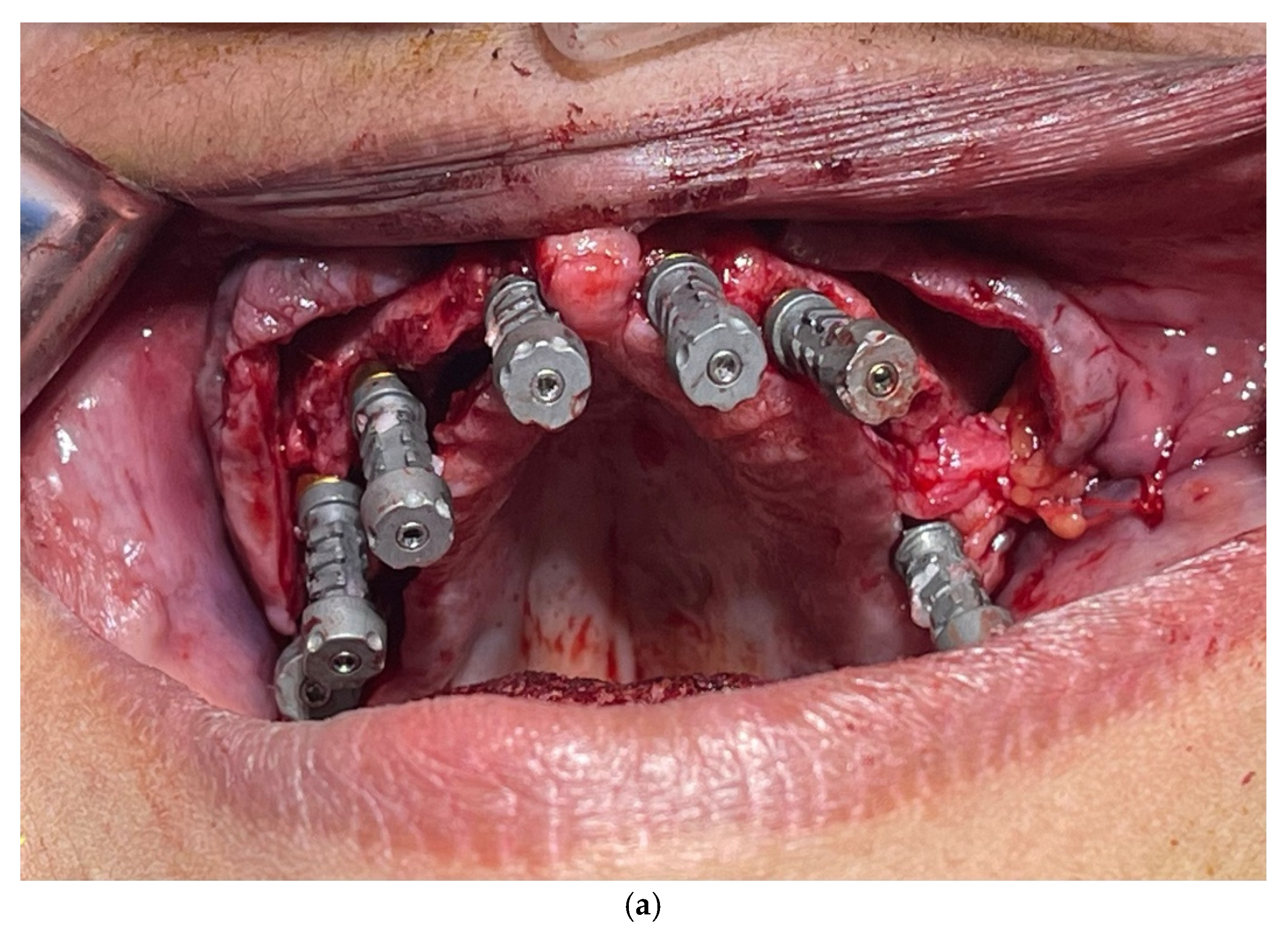 Dentistry 13 00134 g006a