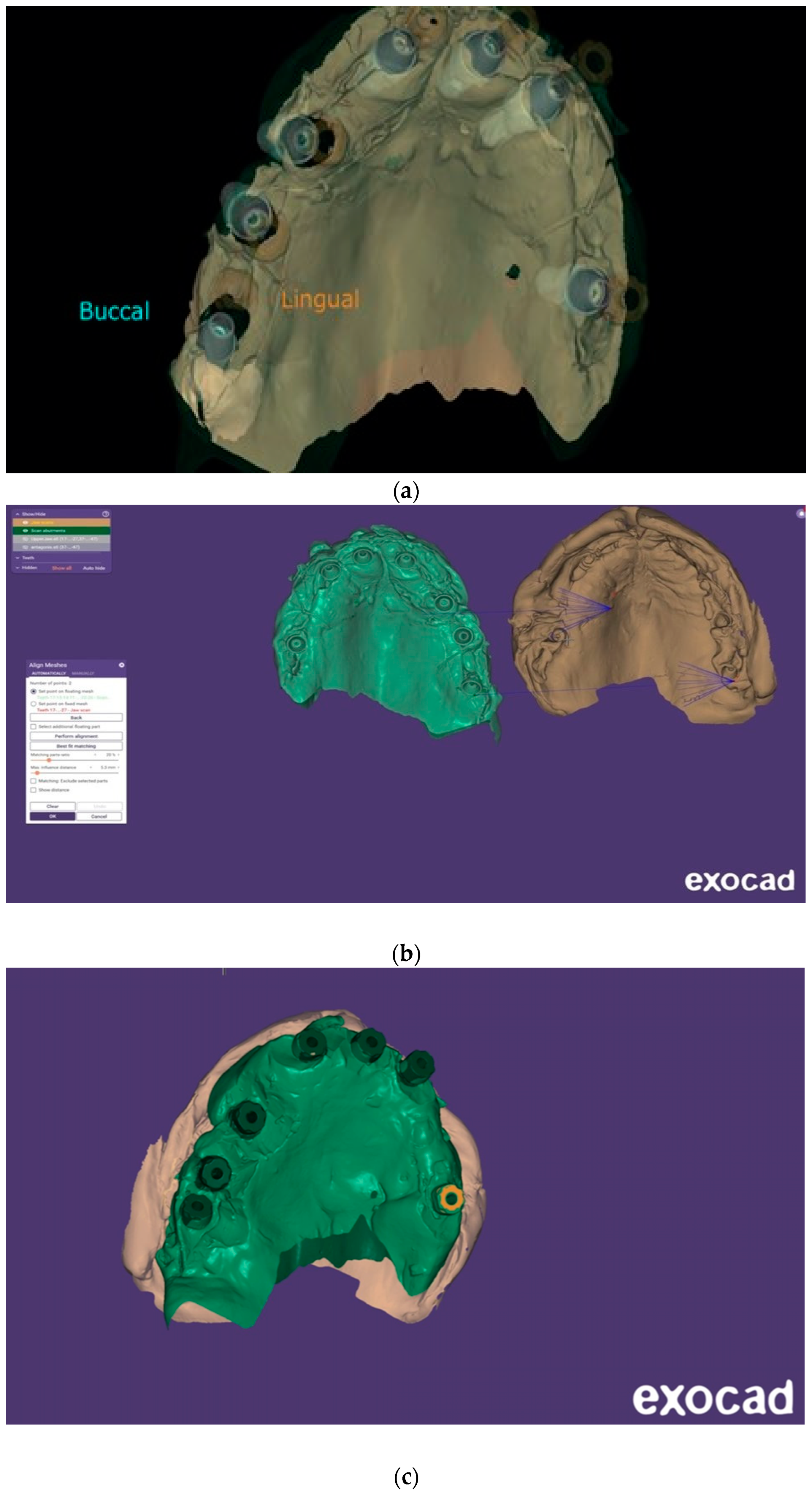 Dentistry 13 00134 g010