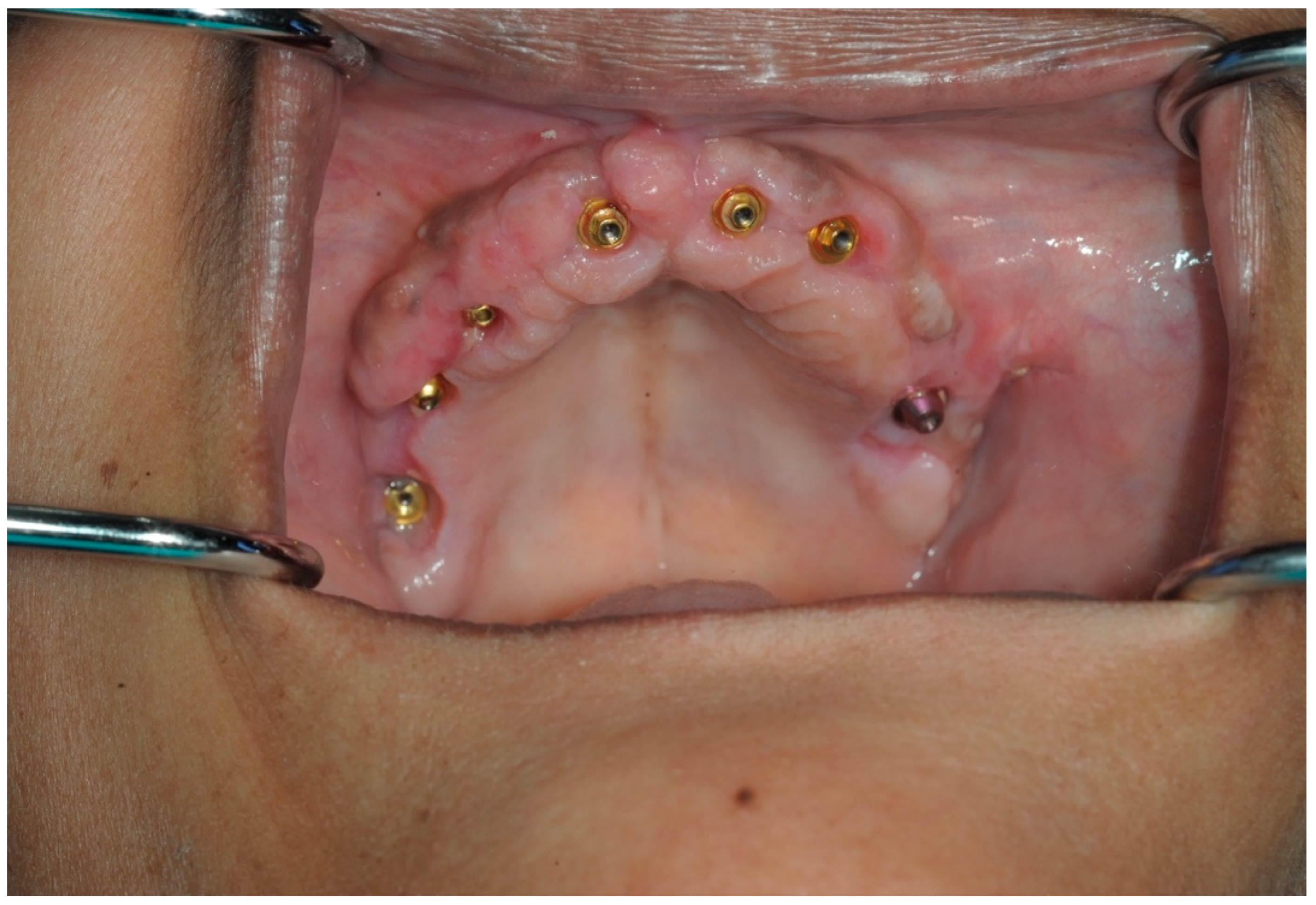 Dentistry 13 00134 g014