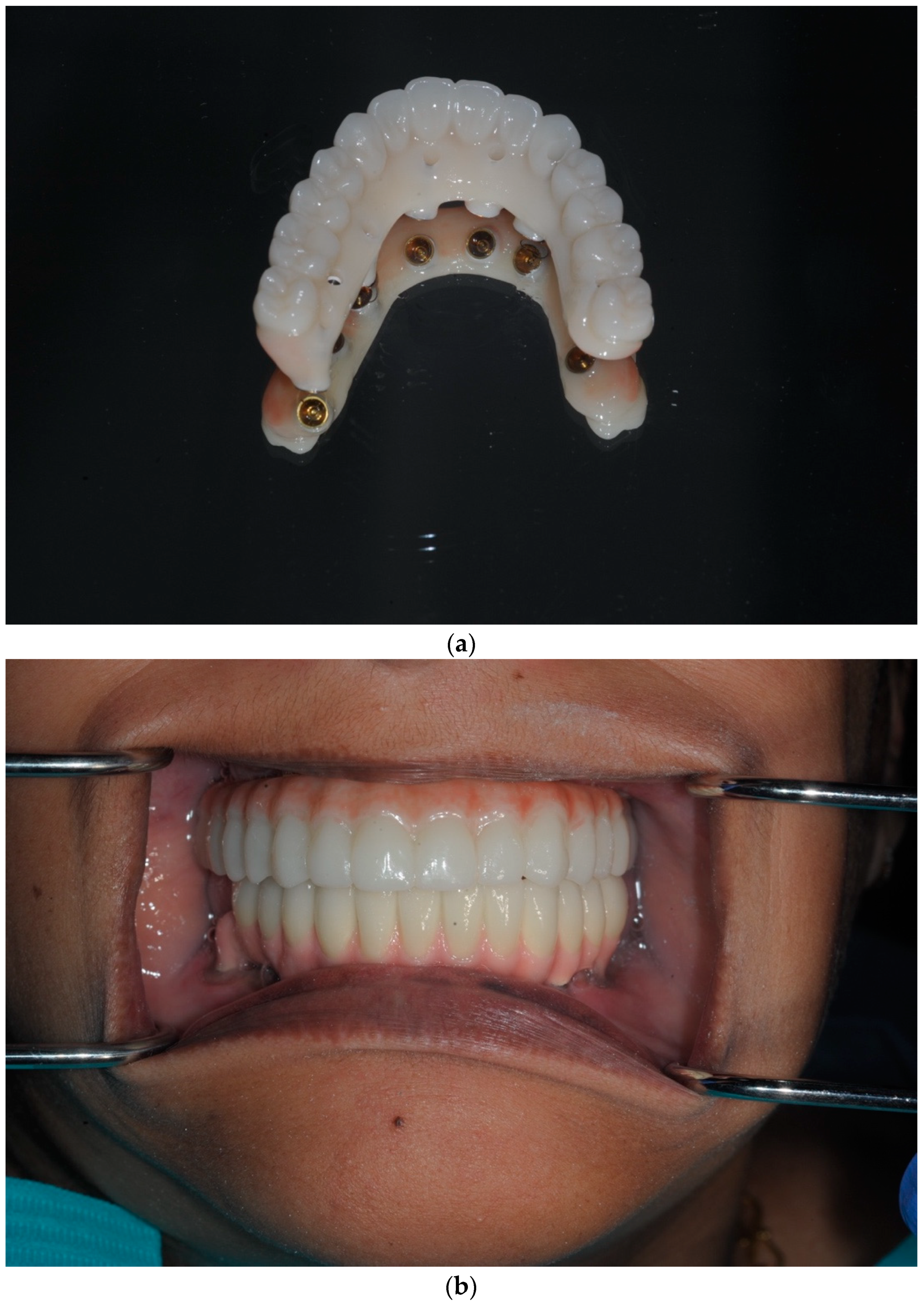 Dentistry 13 00134 g017a