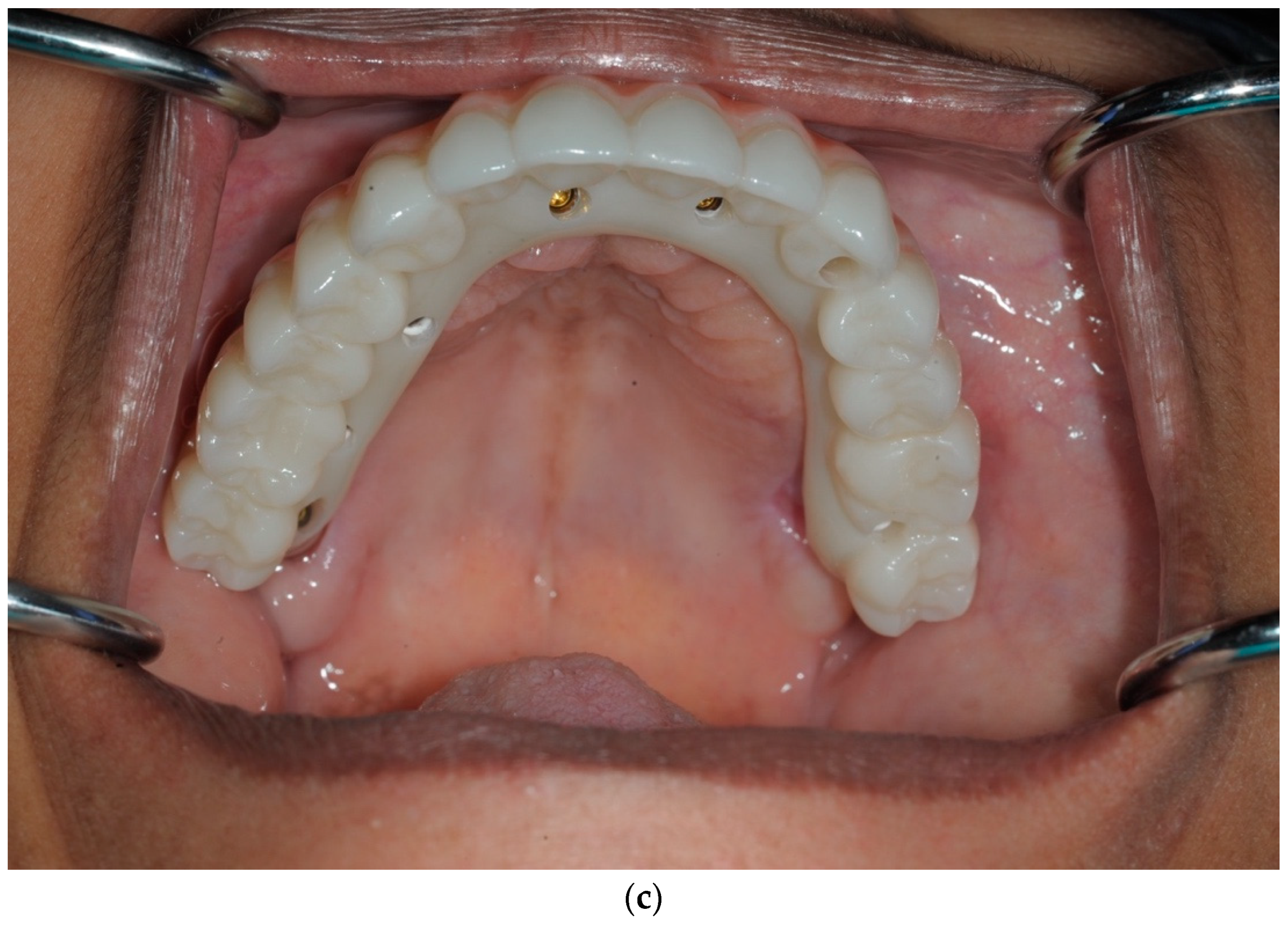 Dentistry 13 00134 g017b