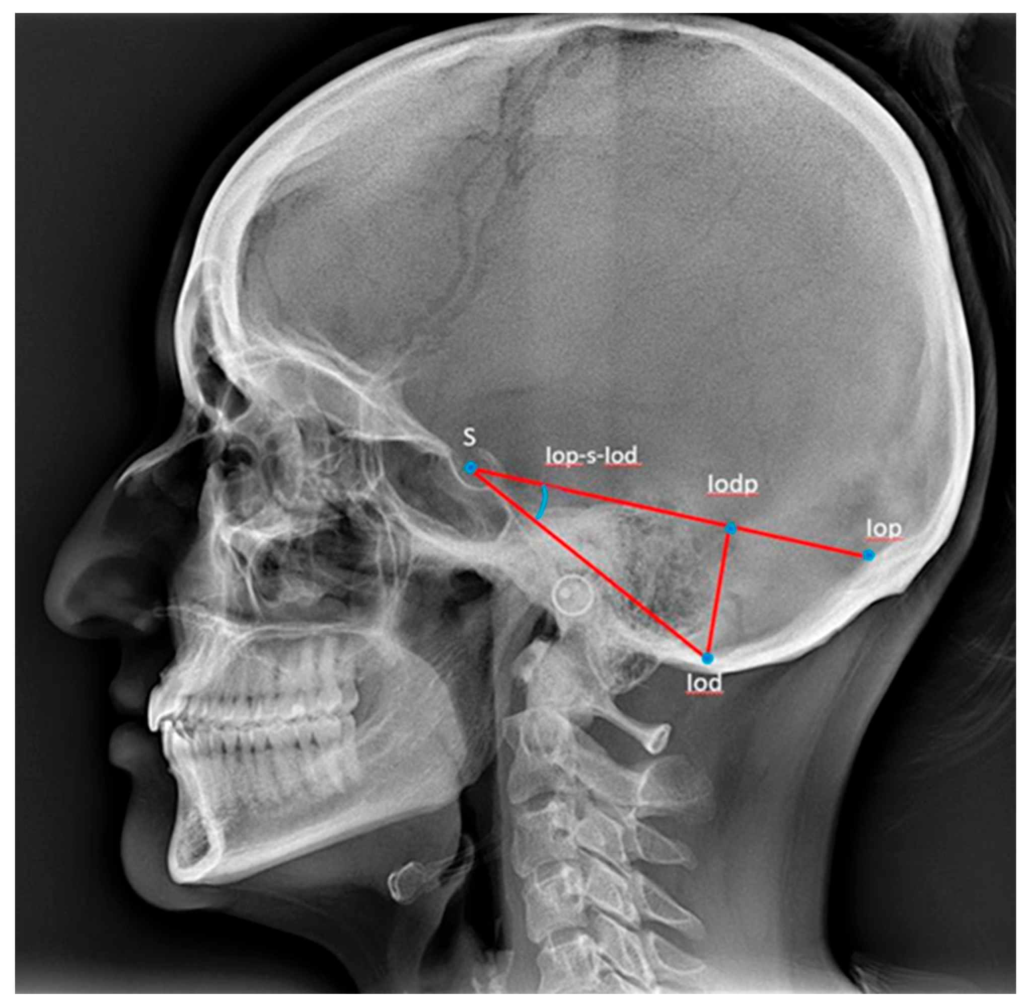 Dentistry 13 00136 g003