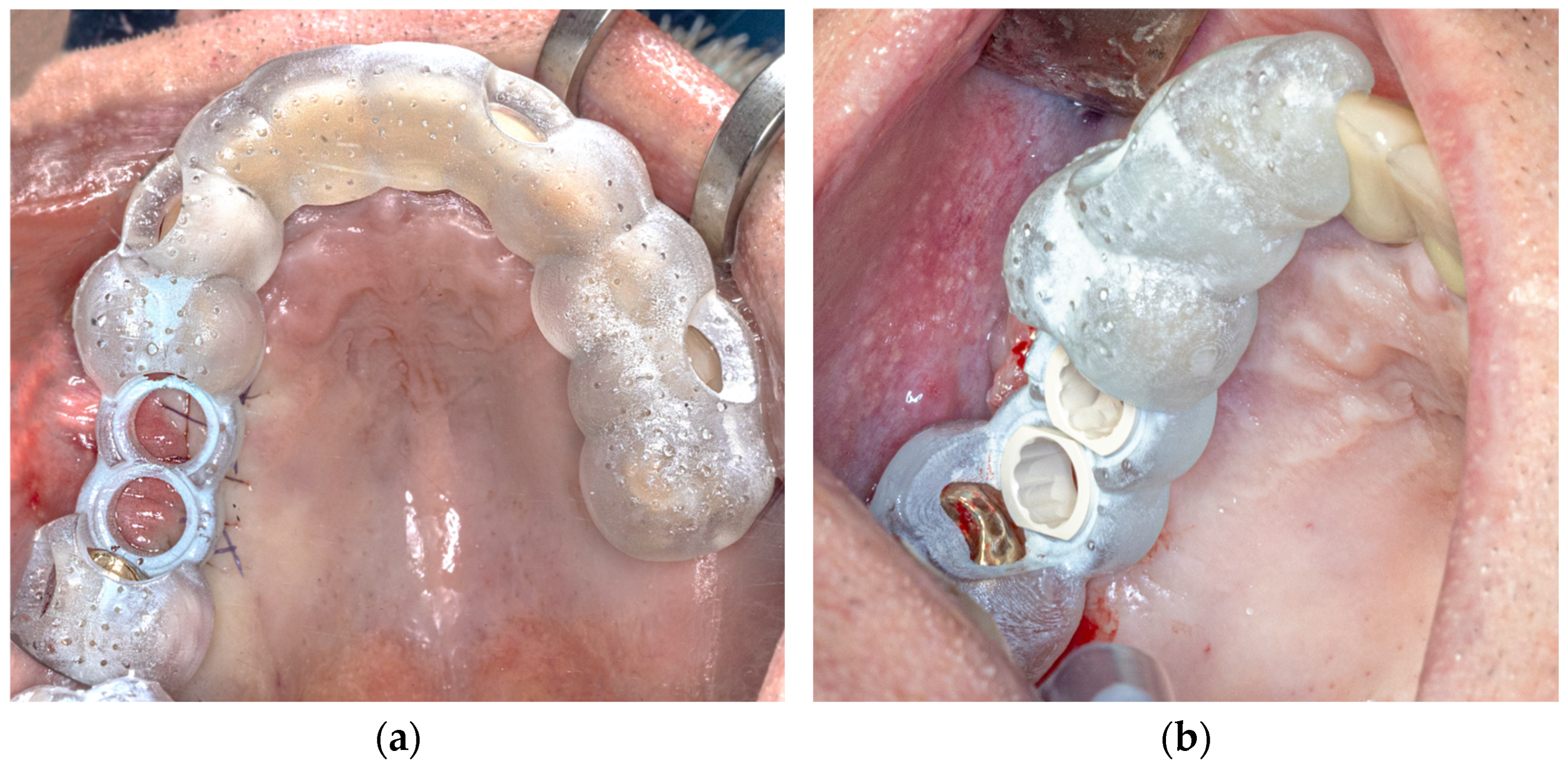 Dentistry 13 00150 g001
