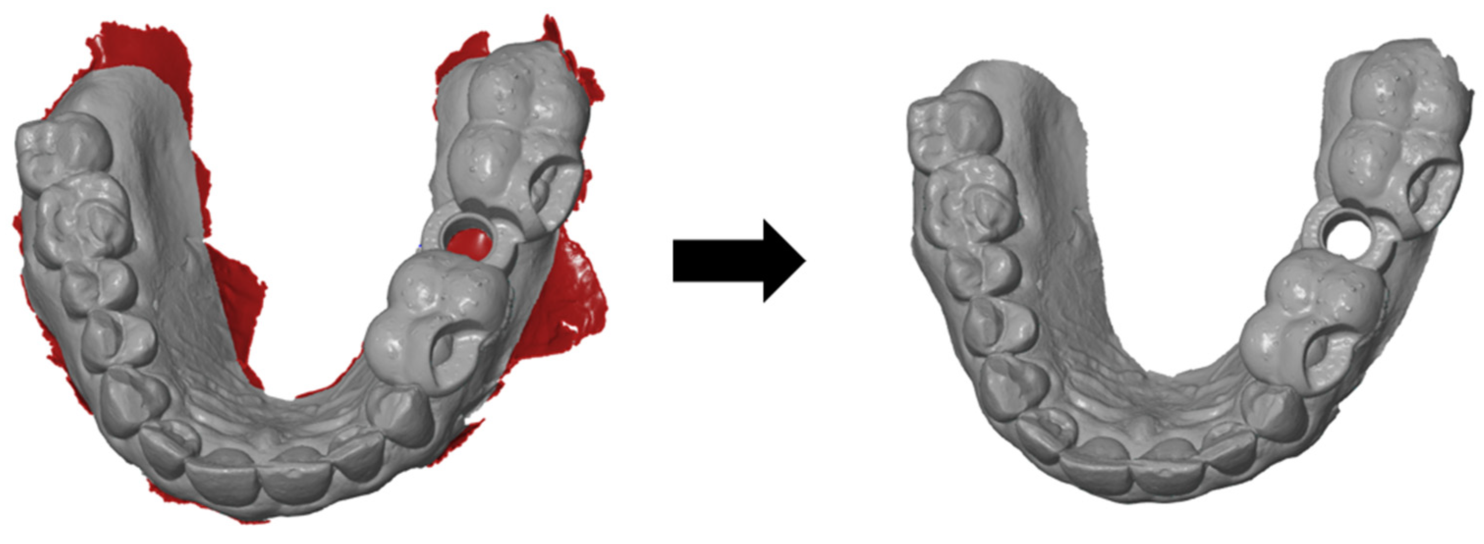 Dentistry 13 00150 g002