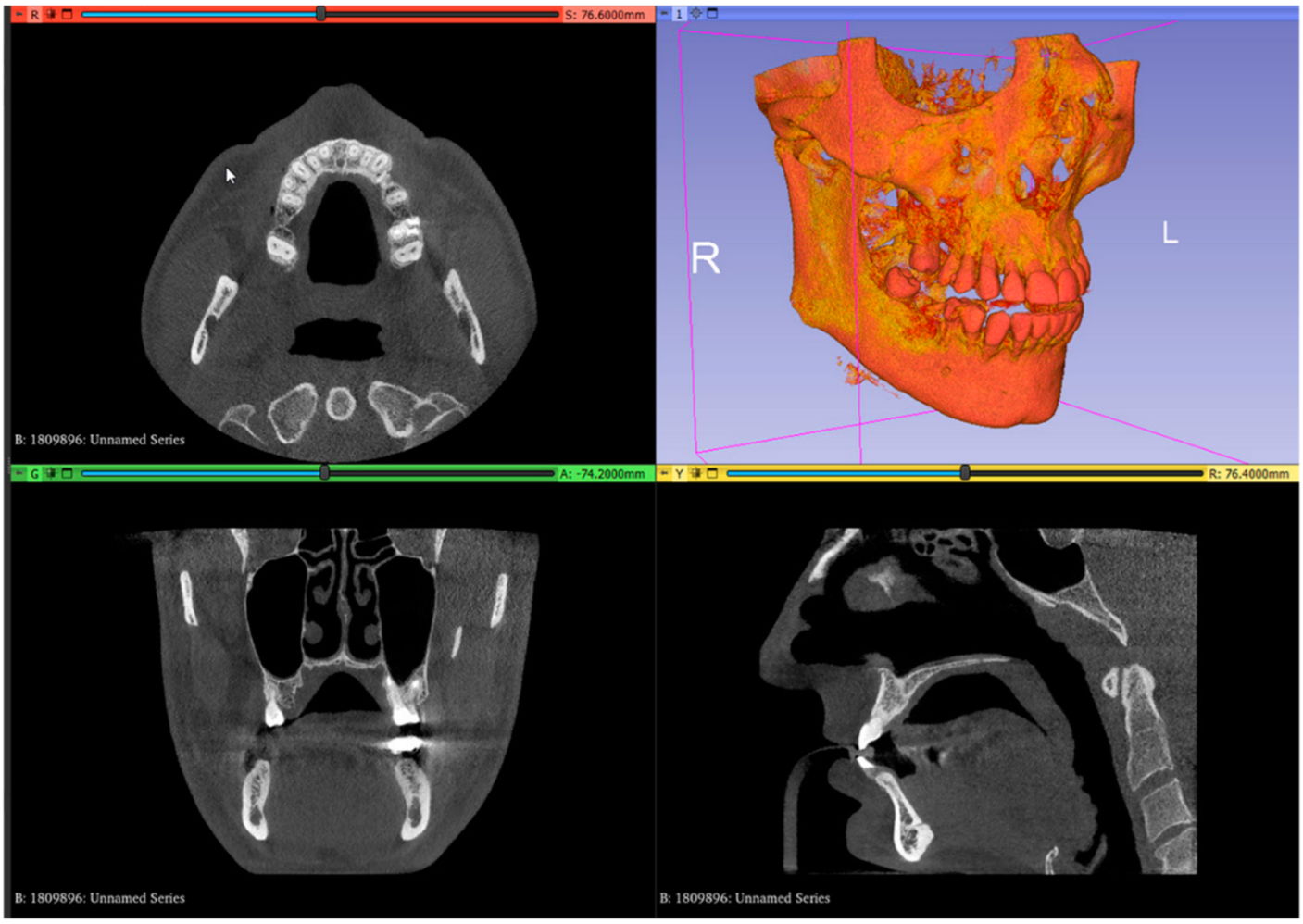 Dentistry 13 00152 g001