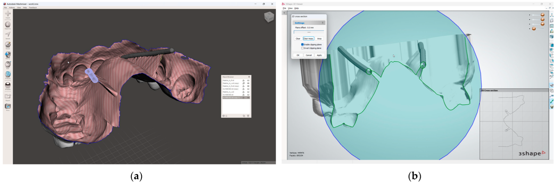 Dentistry 13 00152 g005