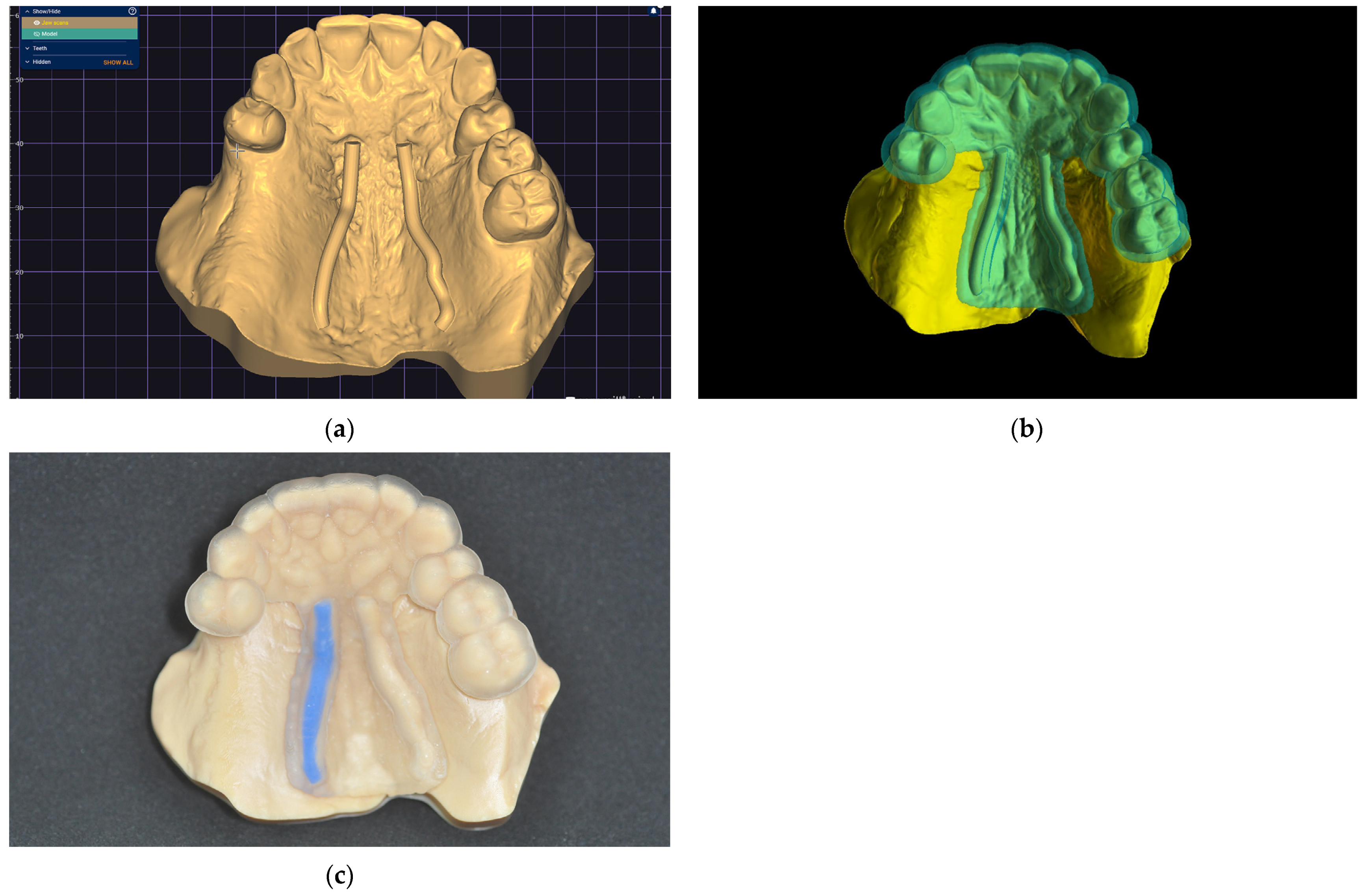 Dentistry 13 00152 g006