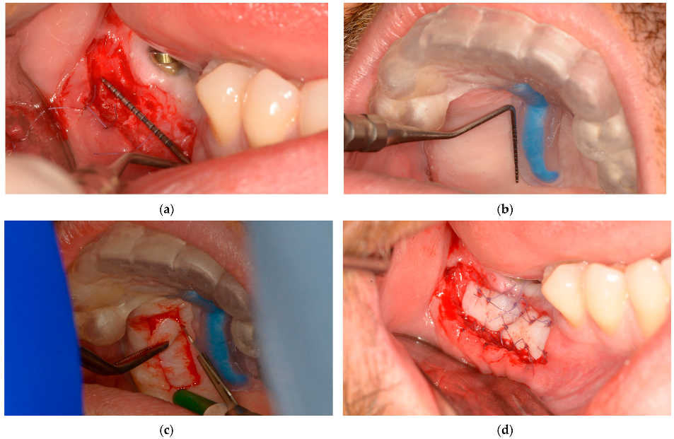 Dentistry 13 00152 g007
