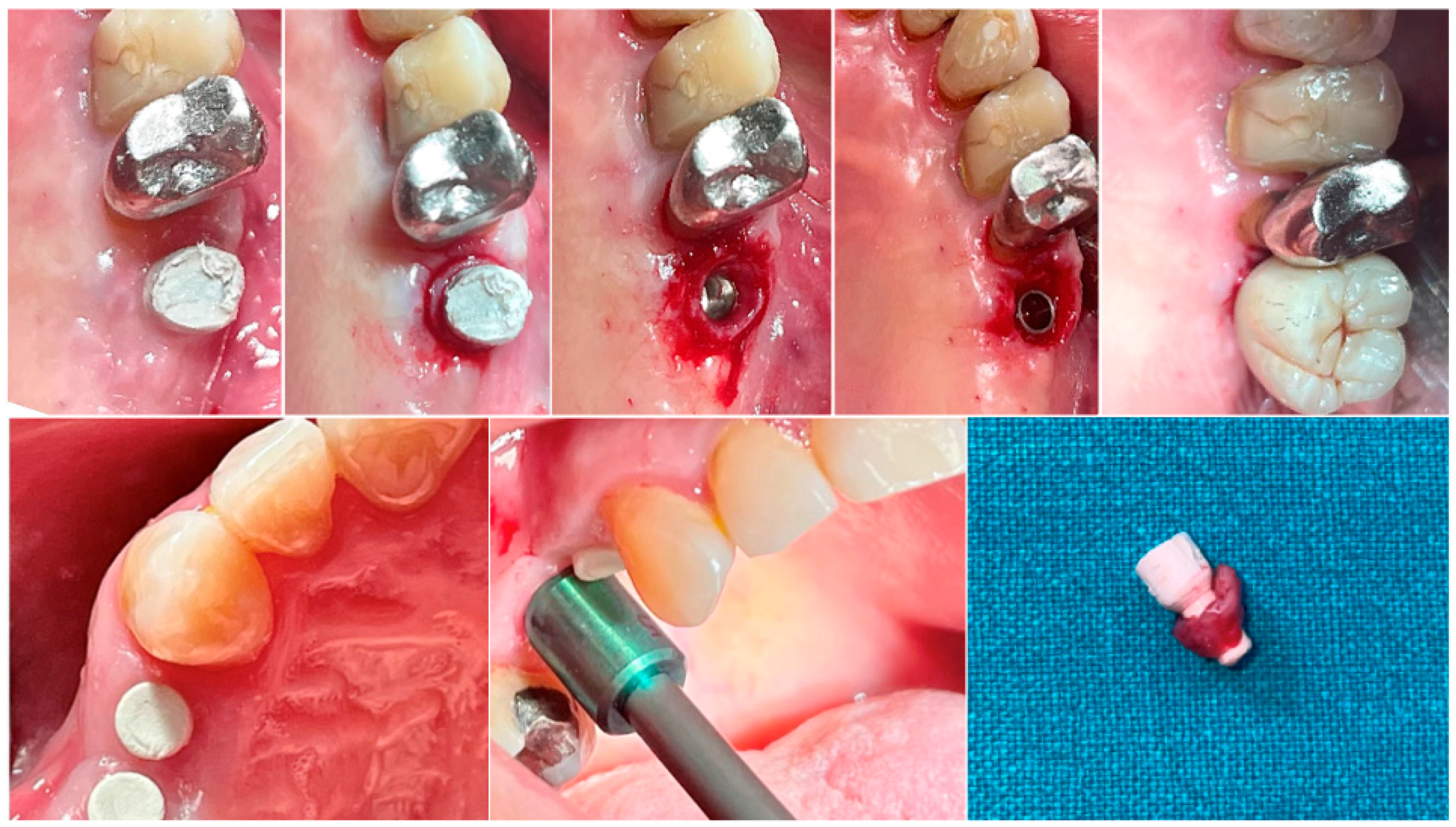 Dentistry 13 00154 g001