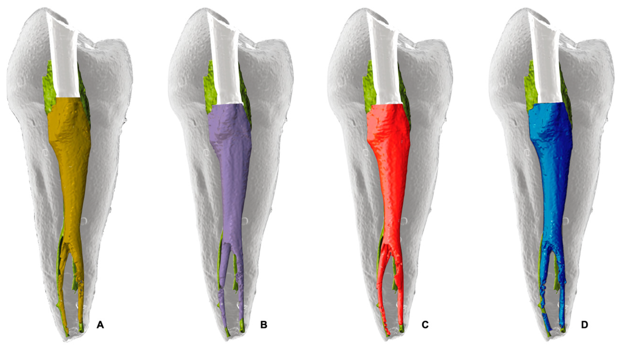 Dentistry 13 00175 g004