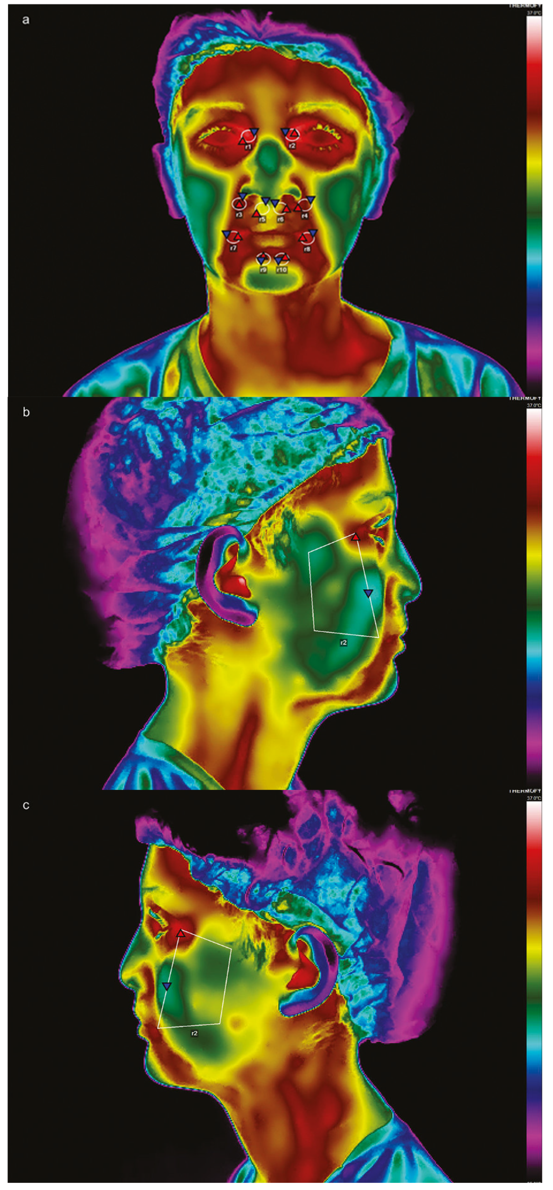 Dentistry 13 00190 g003a