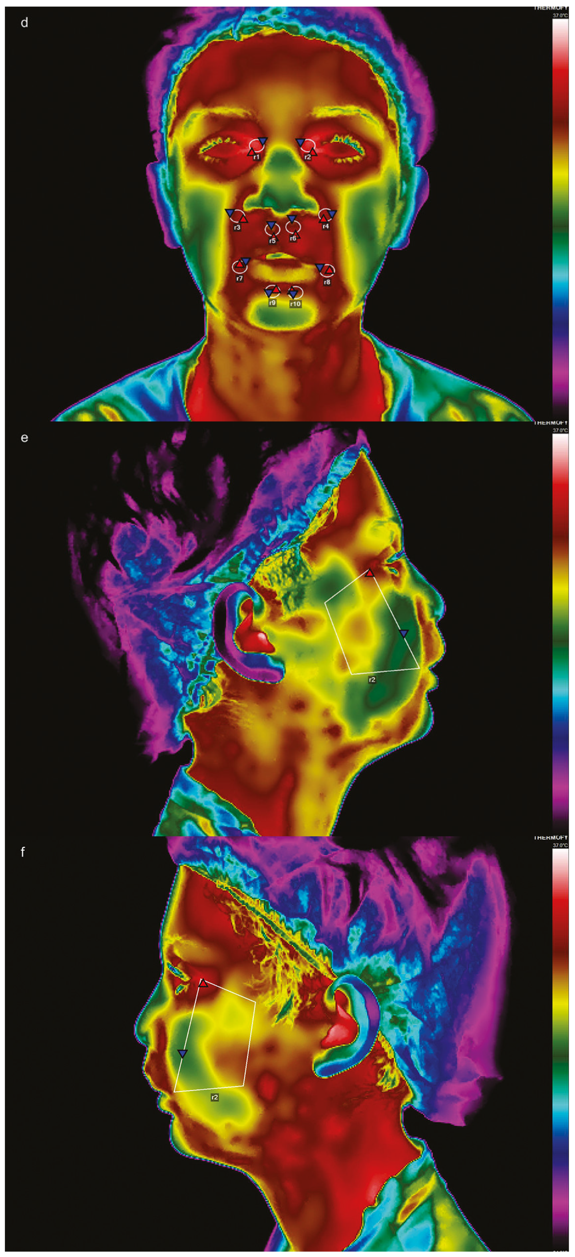 Dentistry 13 00190 g003b