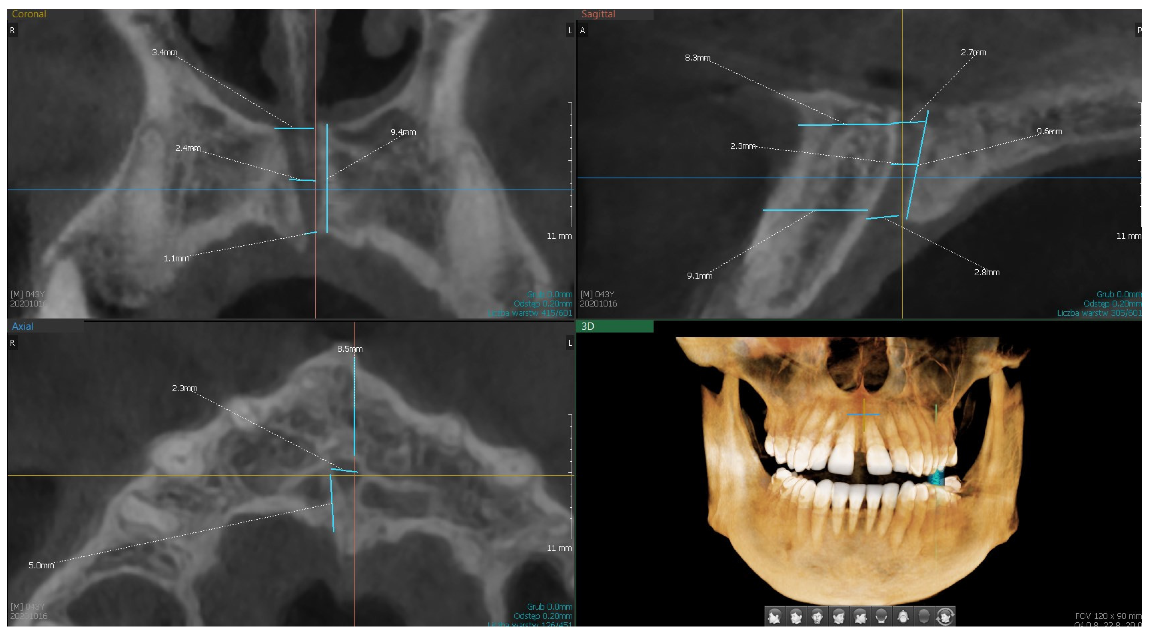 Dentistry 13 00211 g001