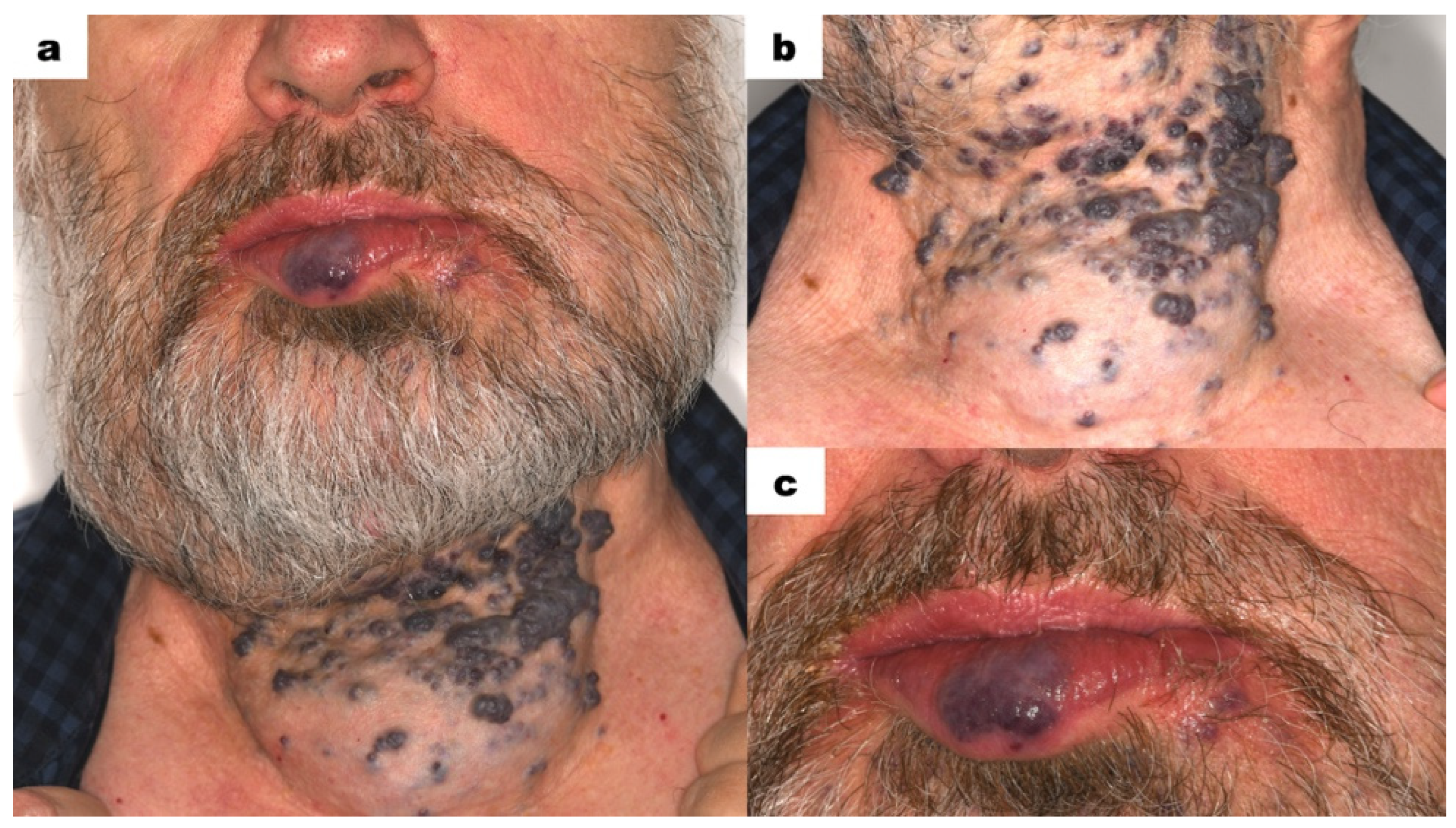 Dentistry 13 00217 g001