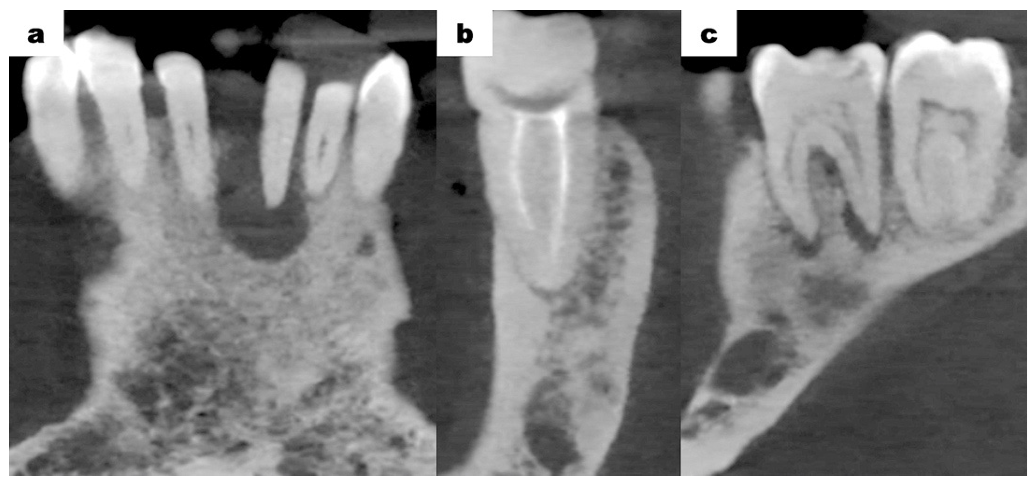 Dentistry 13 00217 g003