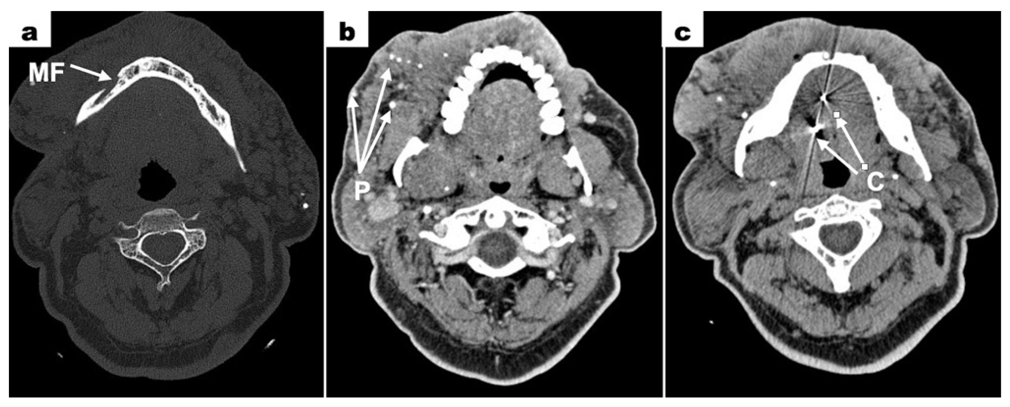 Dentistry 13 00217 g005