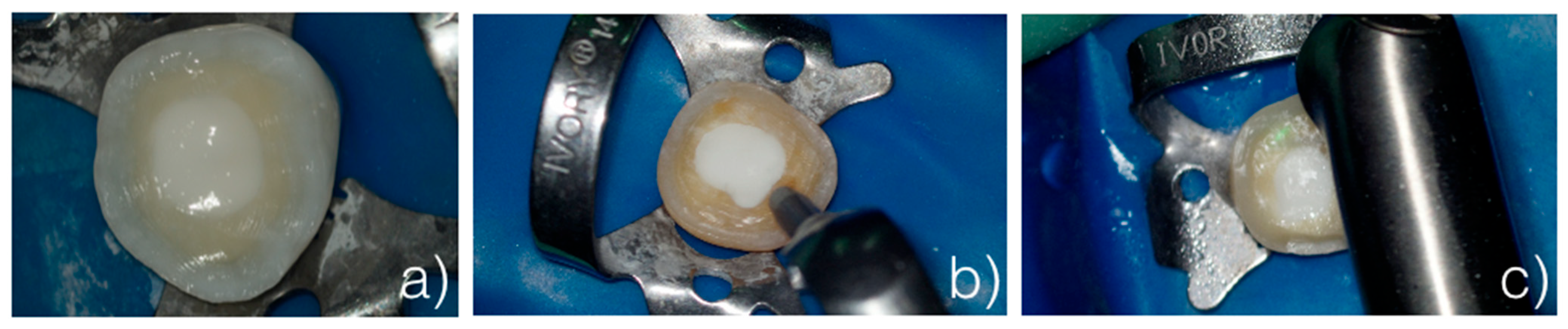 Dentistry 13 00223 g001